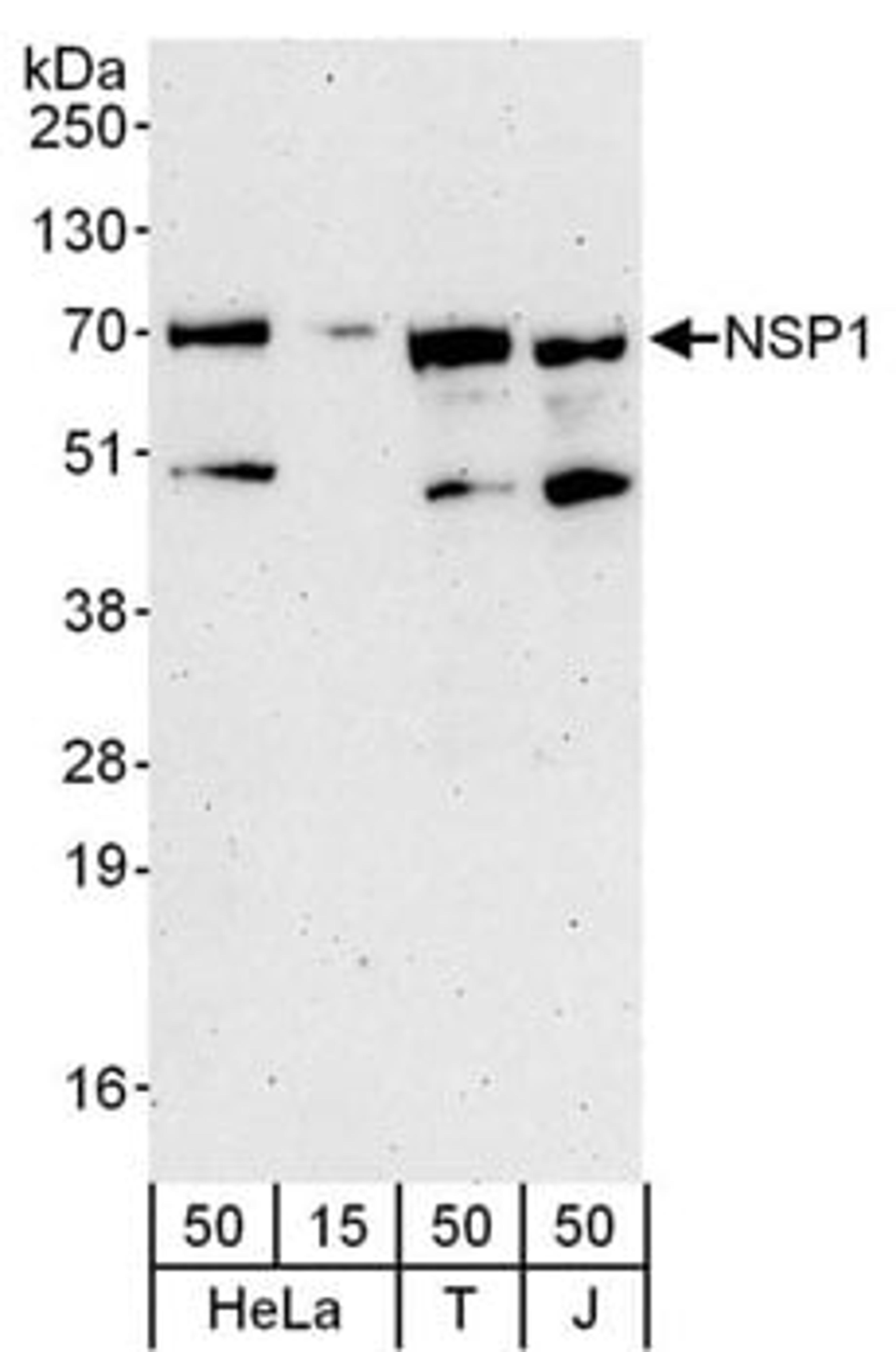 Detection of human NSP1 by western blot.