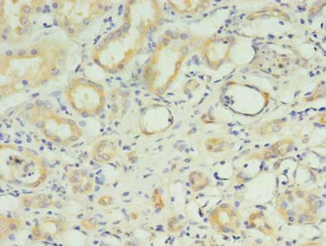 Immunohistochemistry of paraffin-embedded human kidney tissue using CSB-PA019862LA01HU at dilution of 1:100