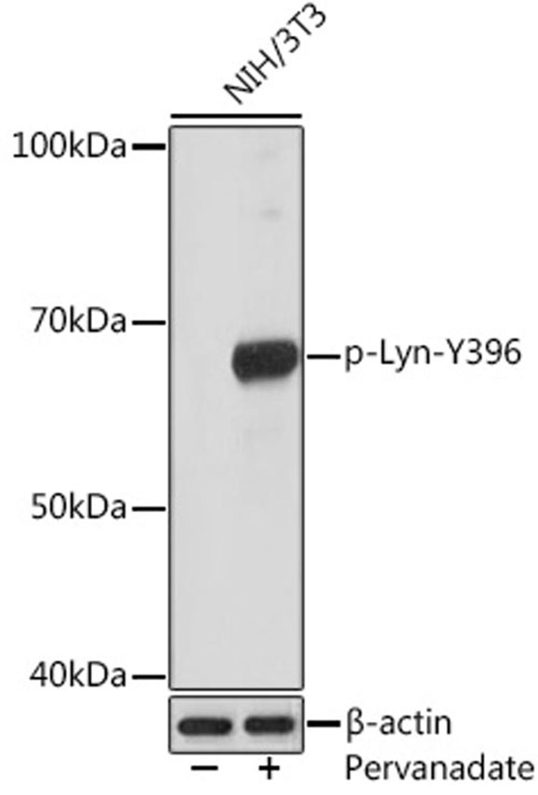 Western blot - Phospho-Lyn-Y396 Rabbit mAb (AP1050)