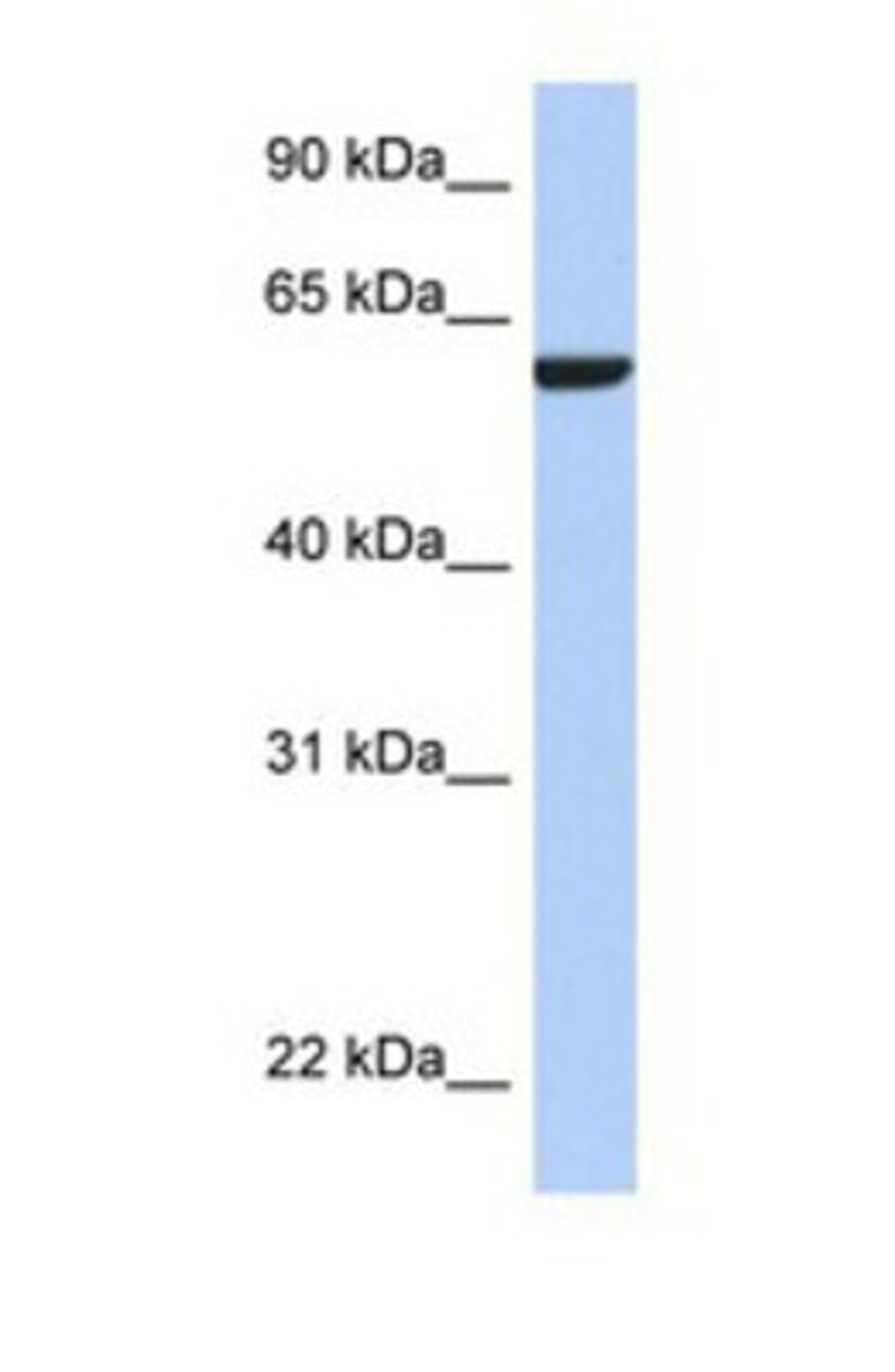 Western Blot: AMIGO3 Antibody [NBP1-69480] - This Anti-AMIGO3 antibody was used in Western Blot of MCF7     tissue lysate at a concentration of 1ug/ml.