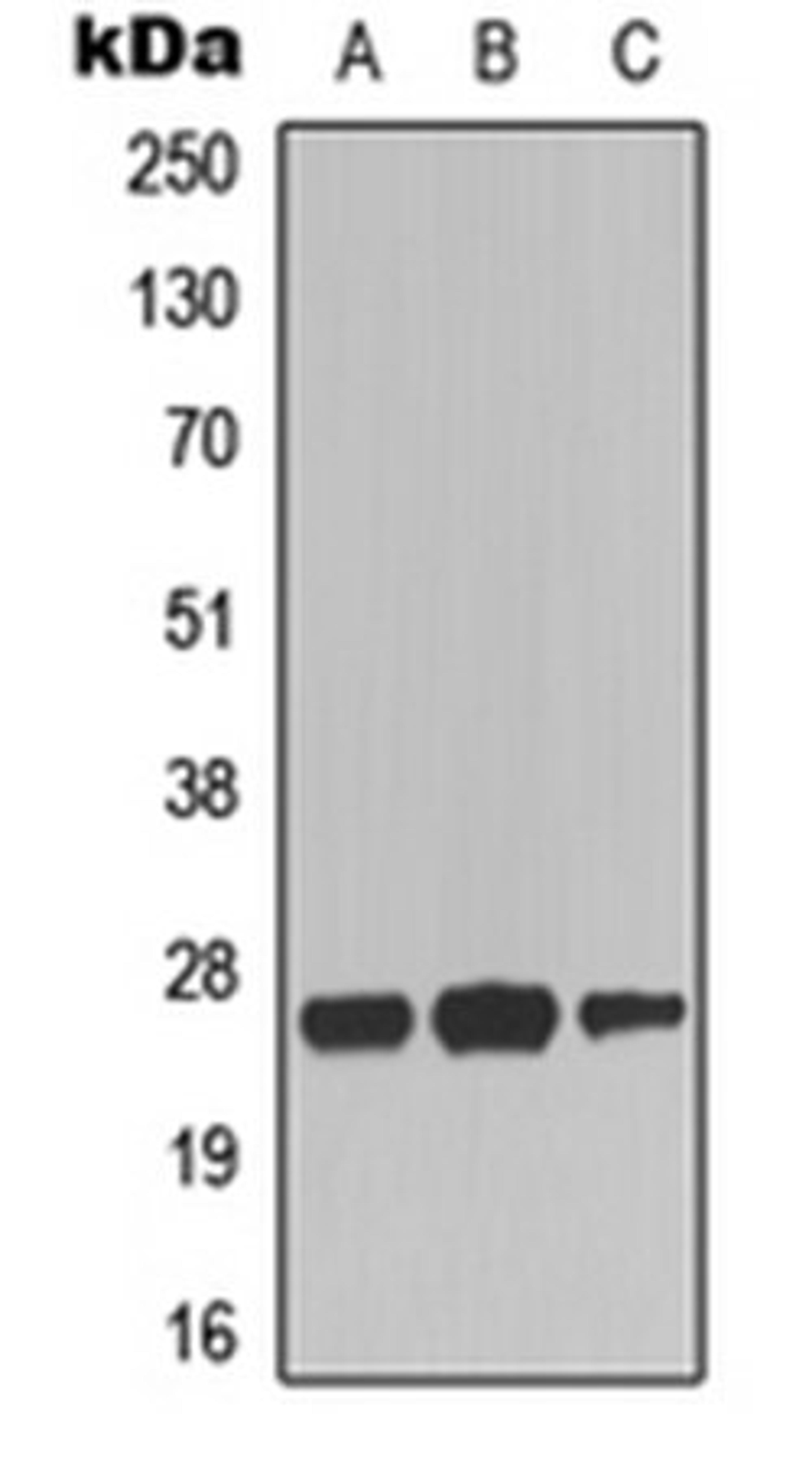 Western blot analysis of HepG2 (Lane 1), NIH3T3 (Lane 2), mouse brain (Lane 3) whole cell lysates using CD137 antibody