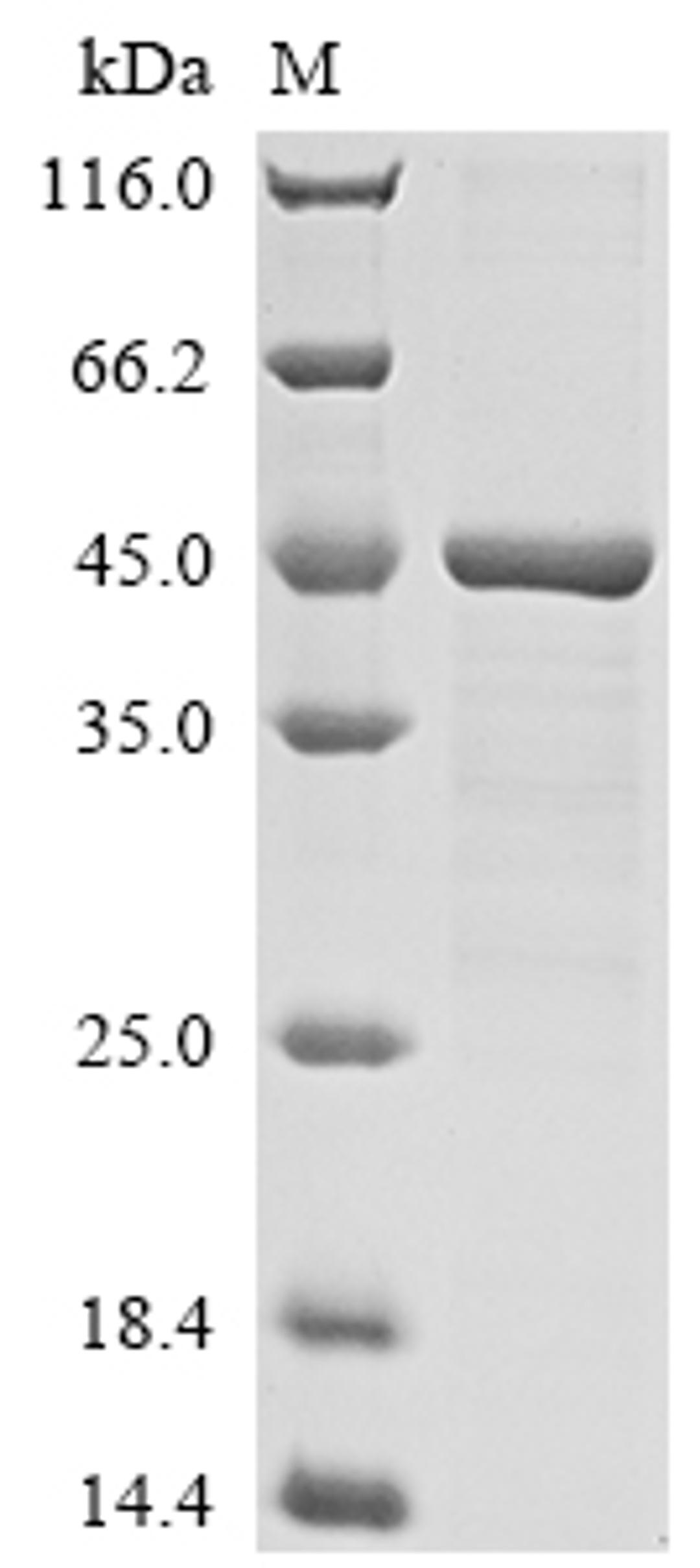(Tris-Glycine gel) Discontinuous SDS-PAGE (reduced) with 5% enrichment gel and 15% separation gel.