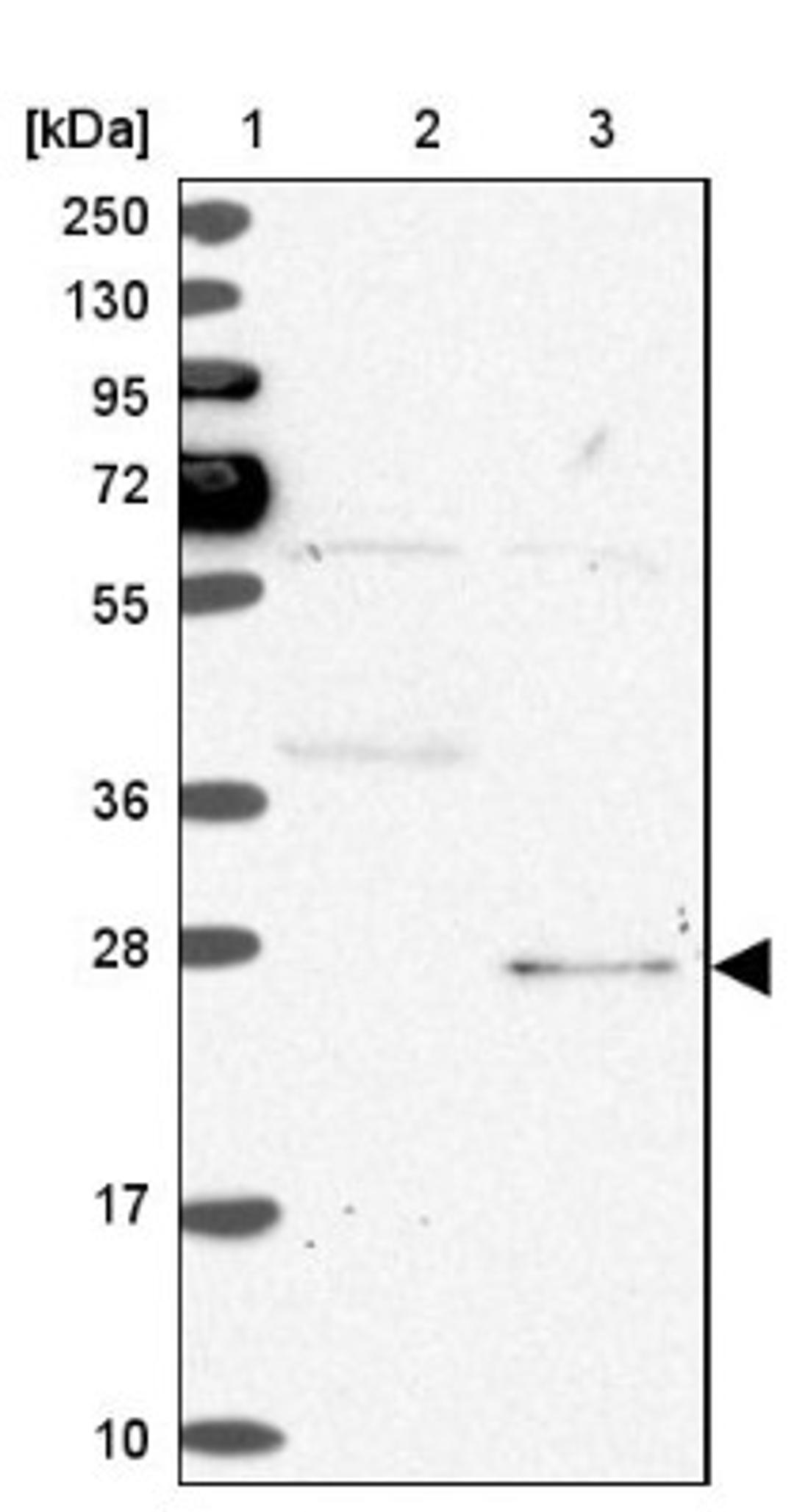 Western Blot: SPC24 Antibody [NBP2-47264] - Lane 1: Marker [kDa] 250, 130, 95, 72, 55, 36, 28, 17, 10.  Lane 2: Human cell line RT-4.  Lane 3: Human cell line U-251MG.