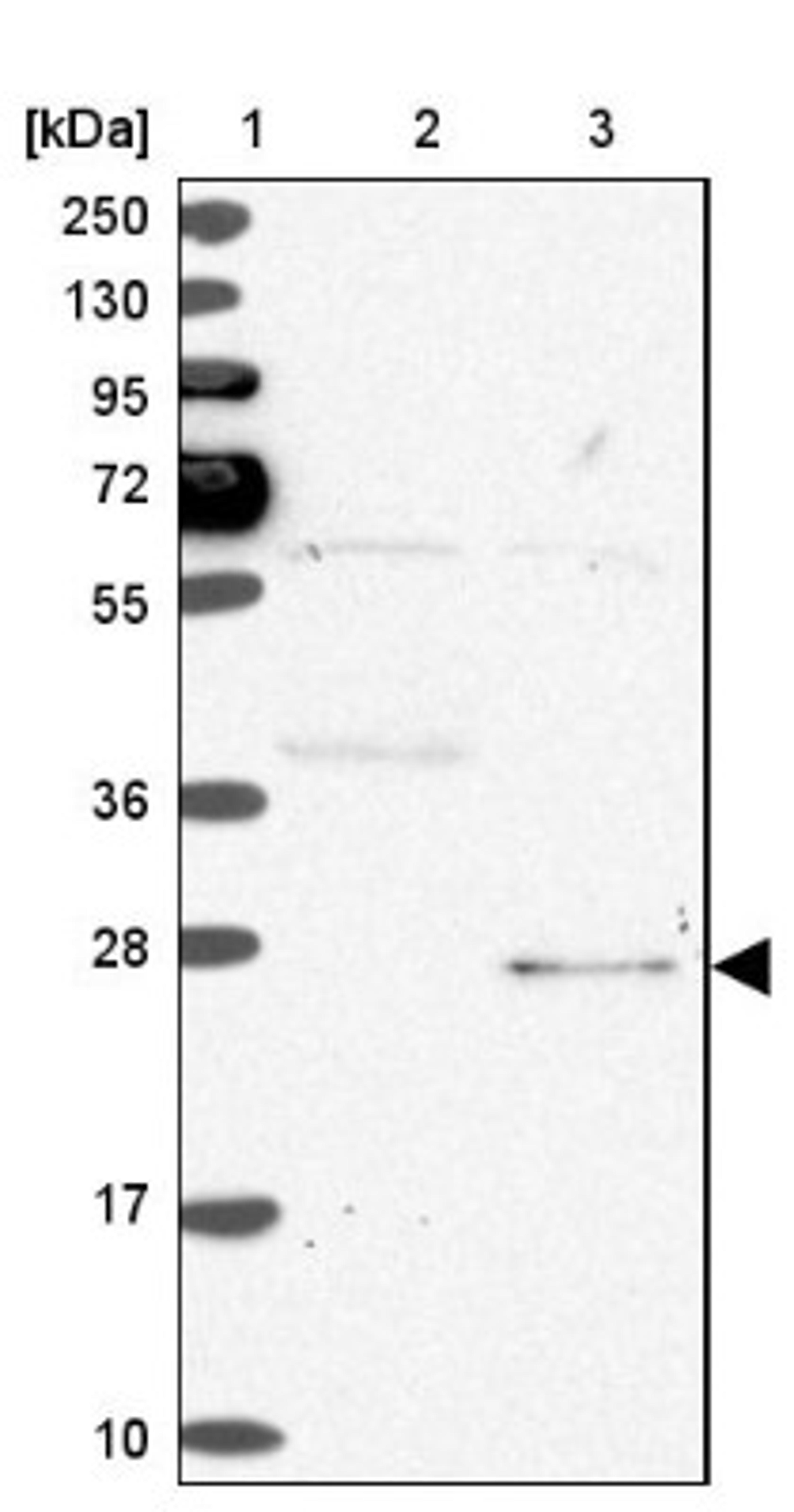 Western Blot: SPC24 Antibody [NBP2-47264] - Lane 1: Marker [kDa] 250, 130, 95, 72, 55, 36, 28, 17, 10.  Lane 2: Human cell line RT-4.  Lane 3: Human cell line U-251MG.