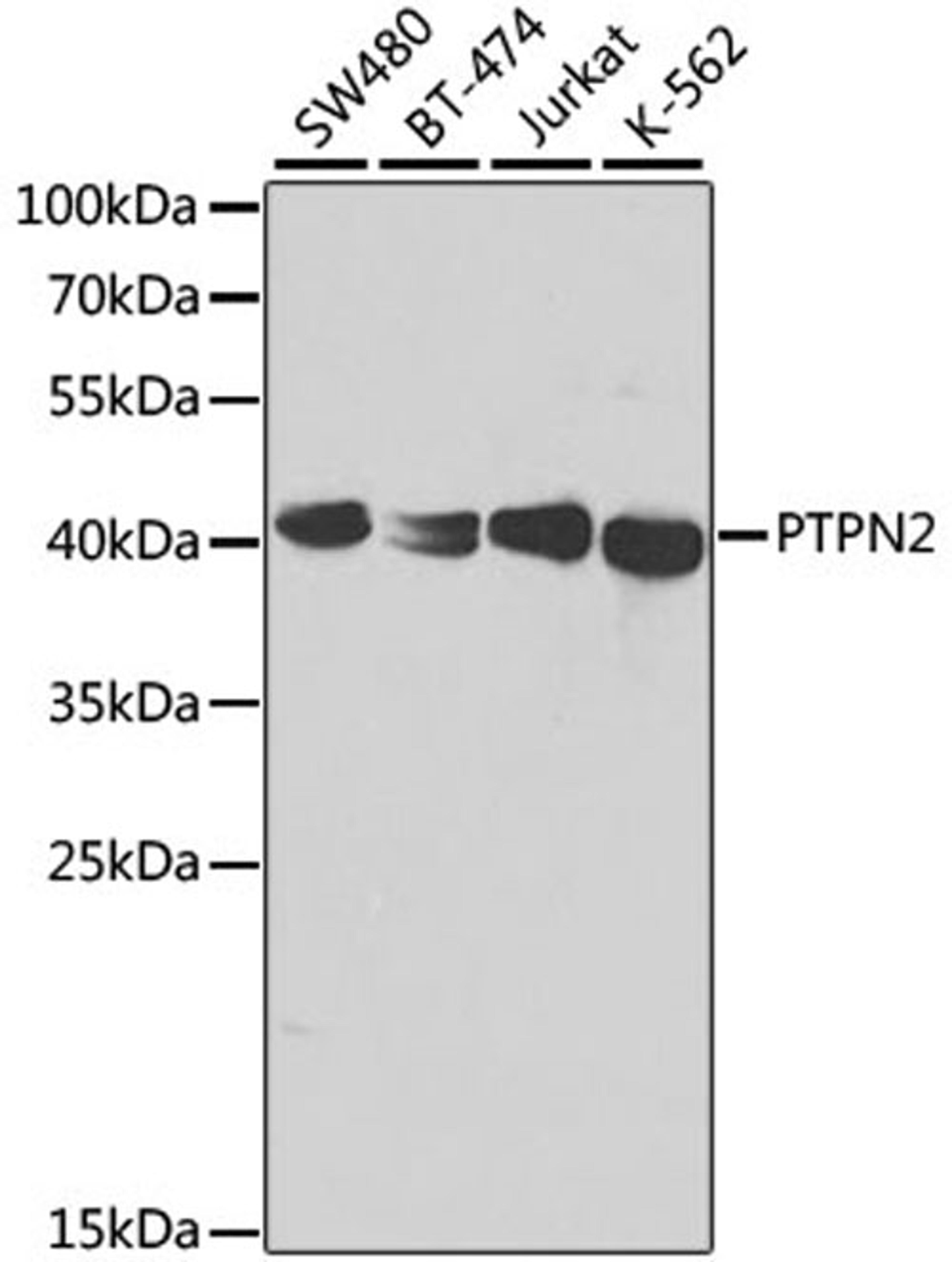 Western blot - PTPN2 antibody (A1808)