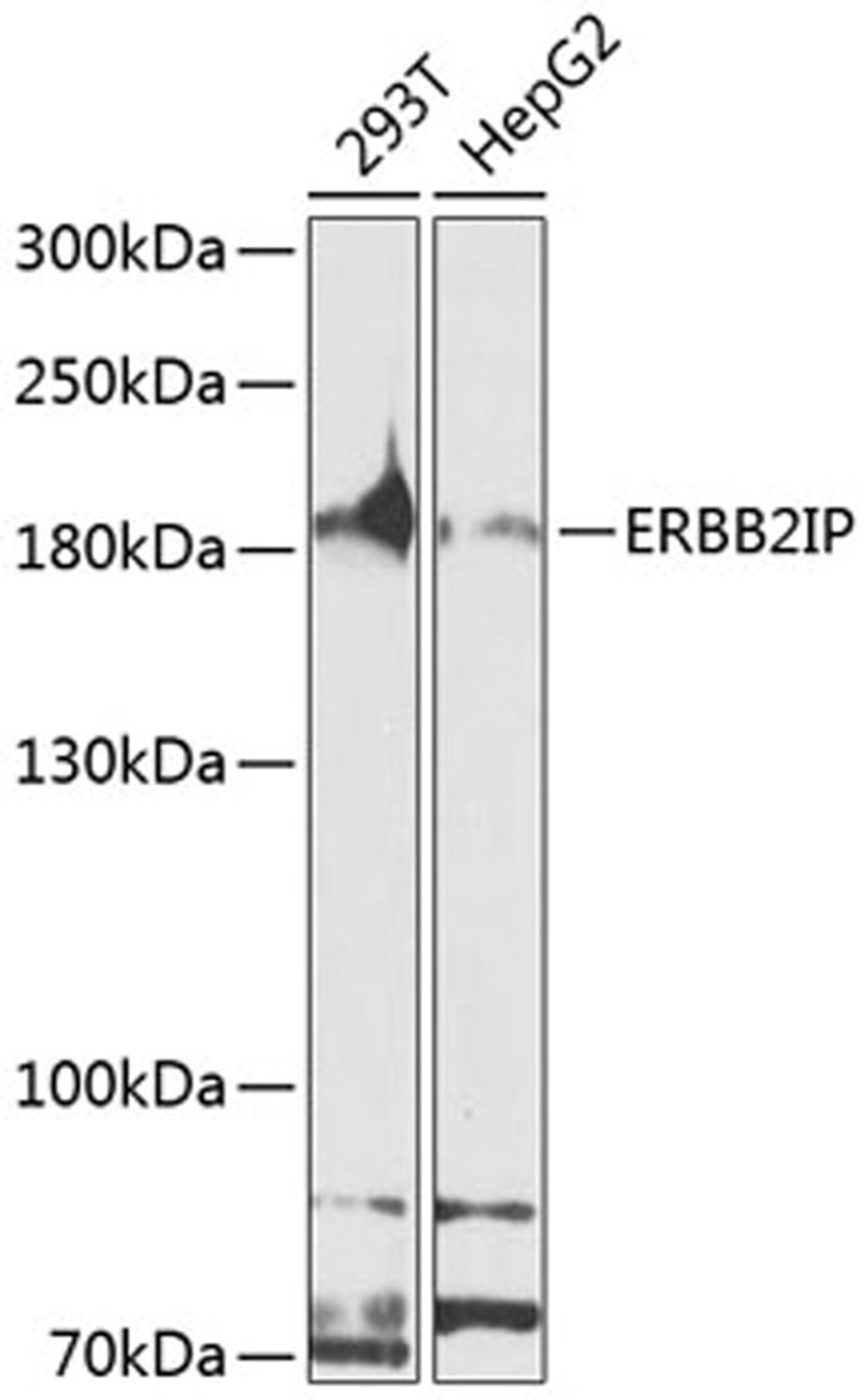 Western blot - ERBB2IP antibody (A8585)