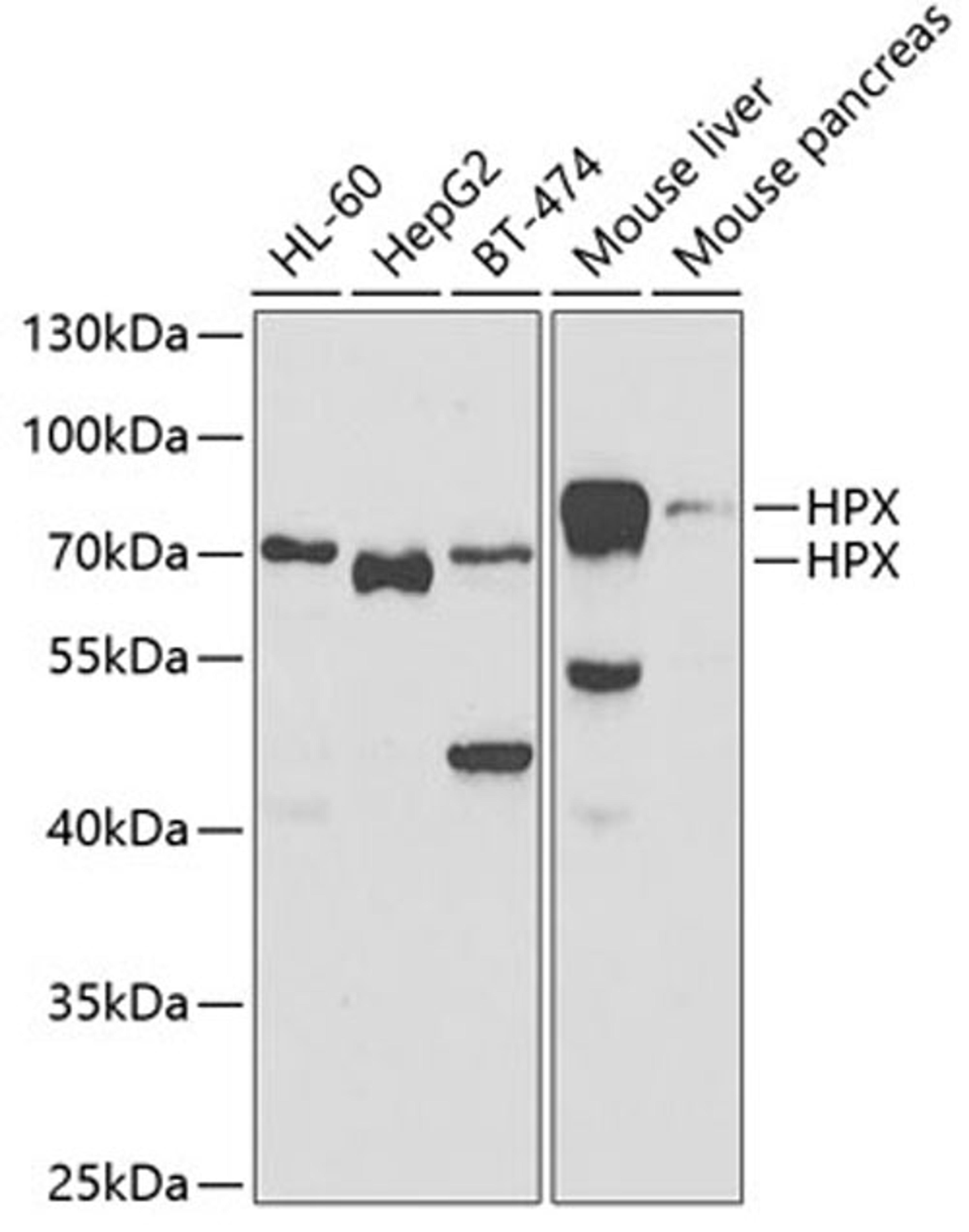 Western blot - HPX antibody (A5603)