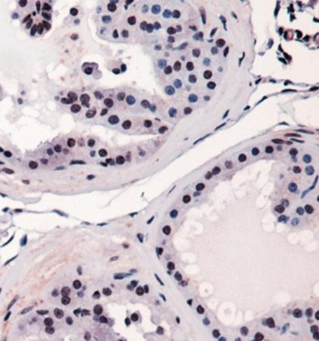 Immunohistochemistry: RUNX2 Antibody [NBP1-77461] - Staining of RUNX2 in mouse prostate using DAB with hematoxylin counterstain.