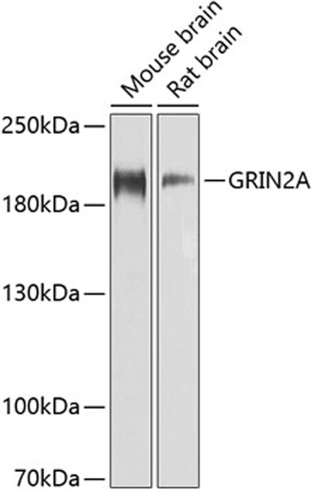 Western blot - GRIN2A antibody (A0924)