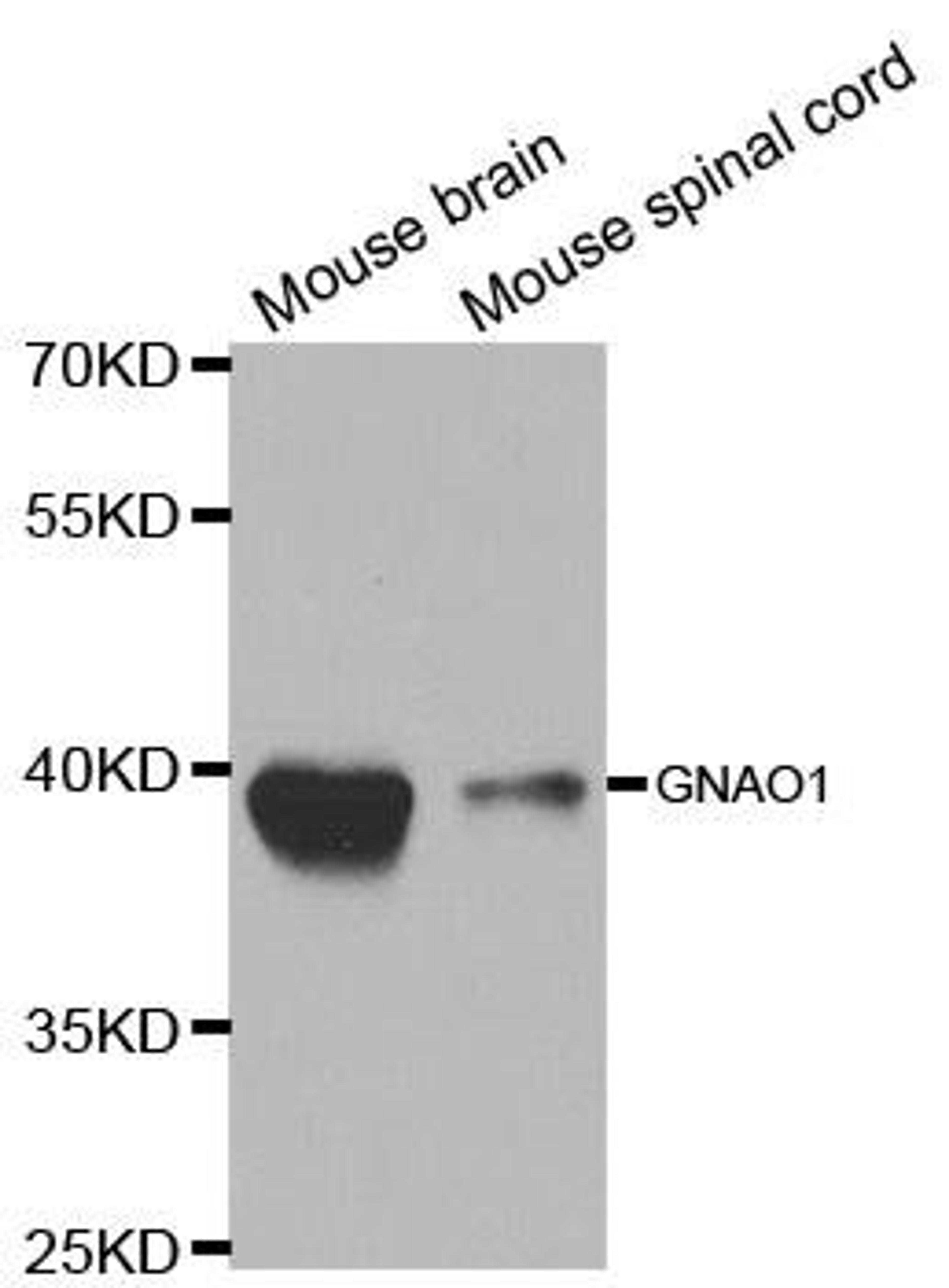 Western blot analysis of extracts of various cell lines using GNAO1 antibody