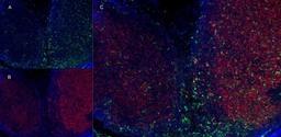 Immunofluorescence staining of mouse lymph node cryosection using Rat anti Mouse CD11b antibody