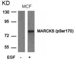 Western blot analysis of lysed extracts from MCF cells untreated or treated with EGF using MARCKS (phospho-Ser170).