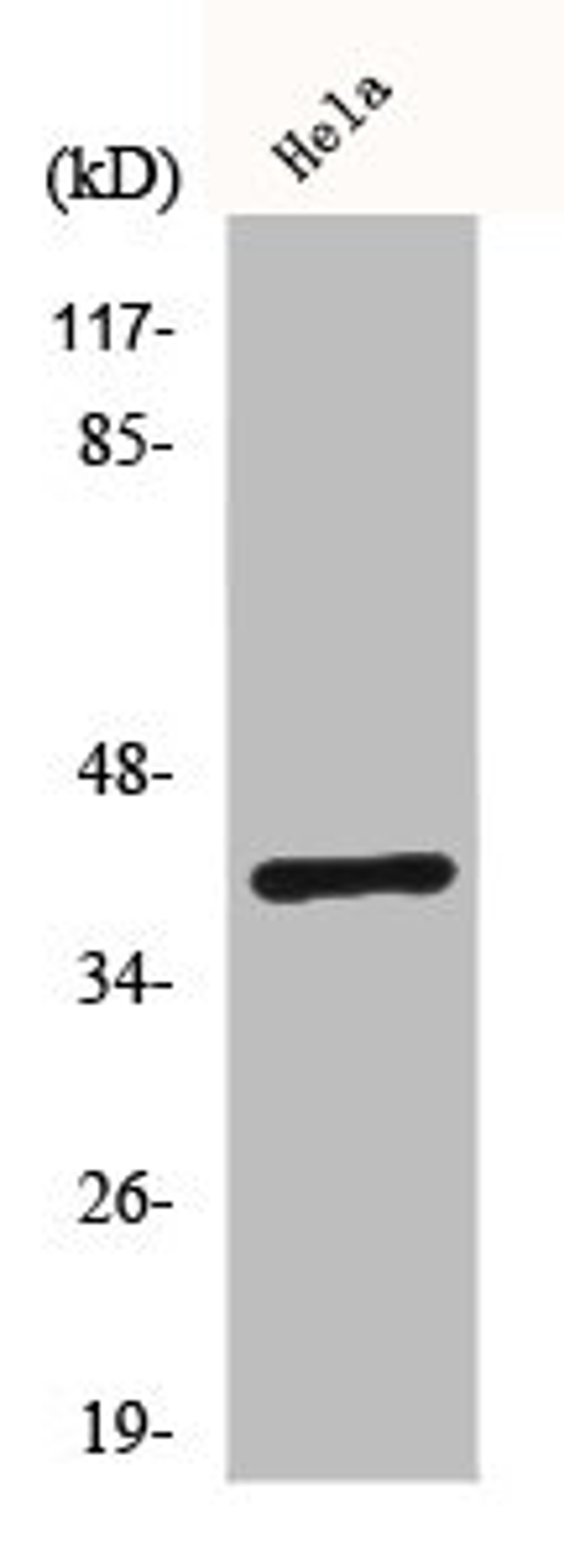 Western Blot analysis of Hela cells using ChemR23 Polyclonal Antibody