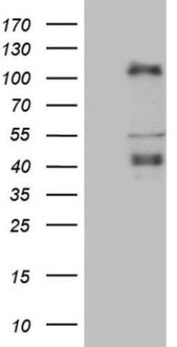 Western Blot: CTBP2 Antibody (4D4) [NBP2-46390] - Analysis of HEK293T cells were transfected with the pCMV6-ENTRY control (Left lane) or pCMV6-ENTRY CTBP2.