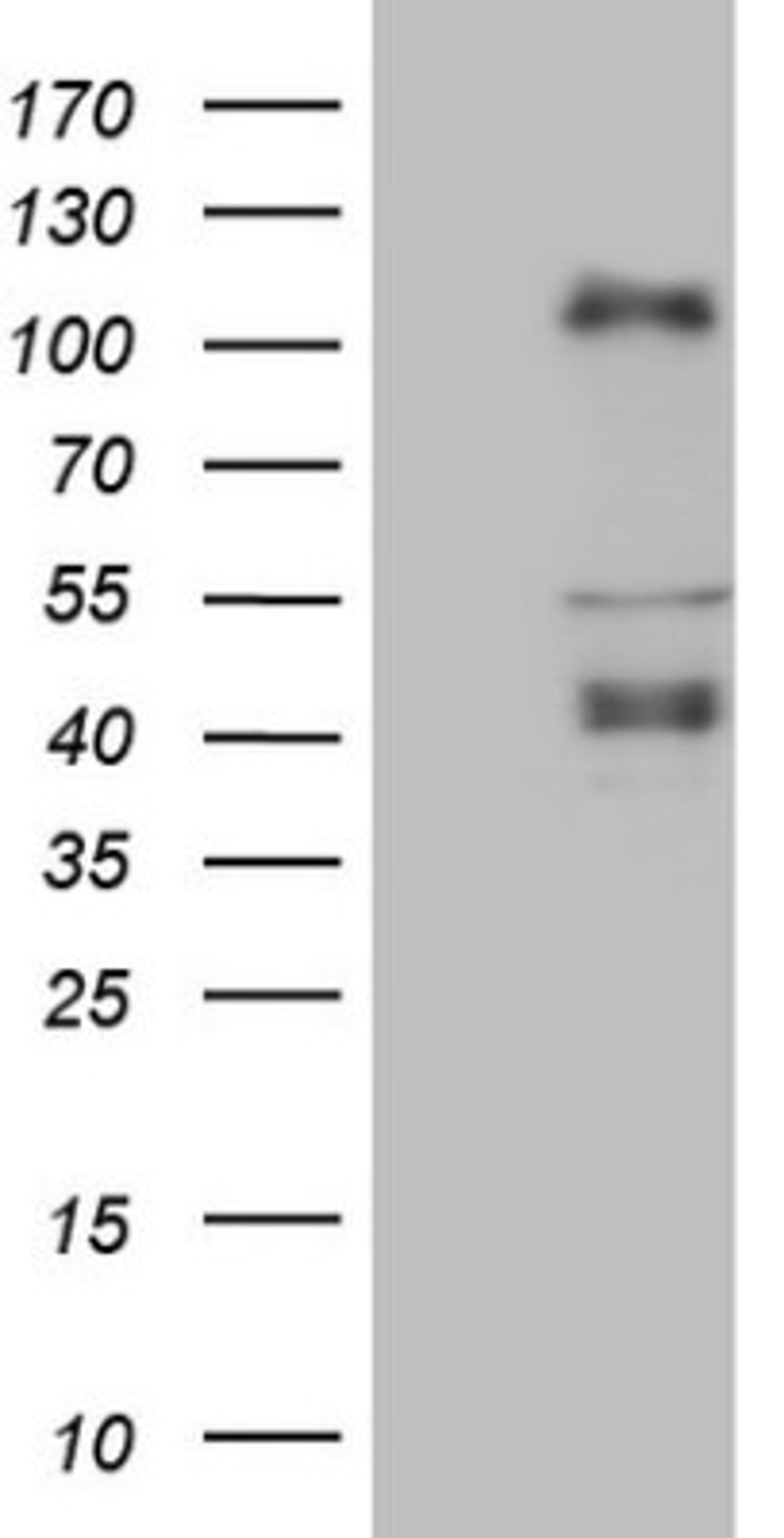 Western Blot: CTBP2 Antibody (4D4) [NBP2-46390] - Analysis of HEK293T cells were transfected with the pCMV6-ENTRY control (Left lane) or pCMV6-ENTRY CTBP2.