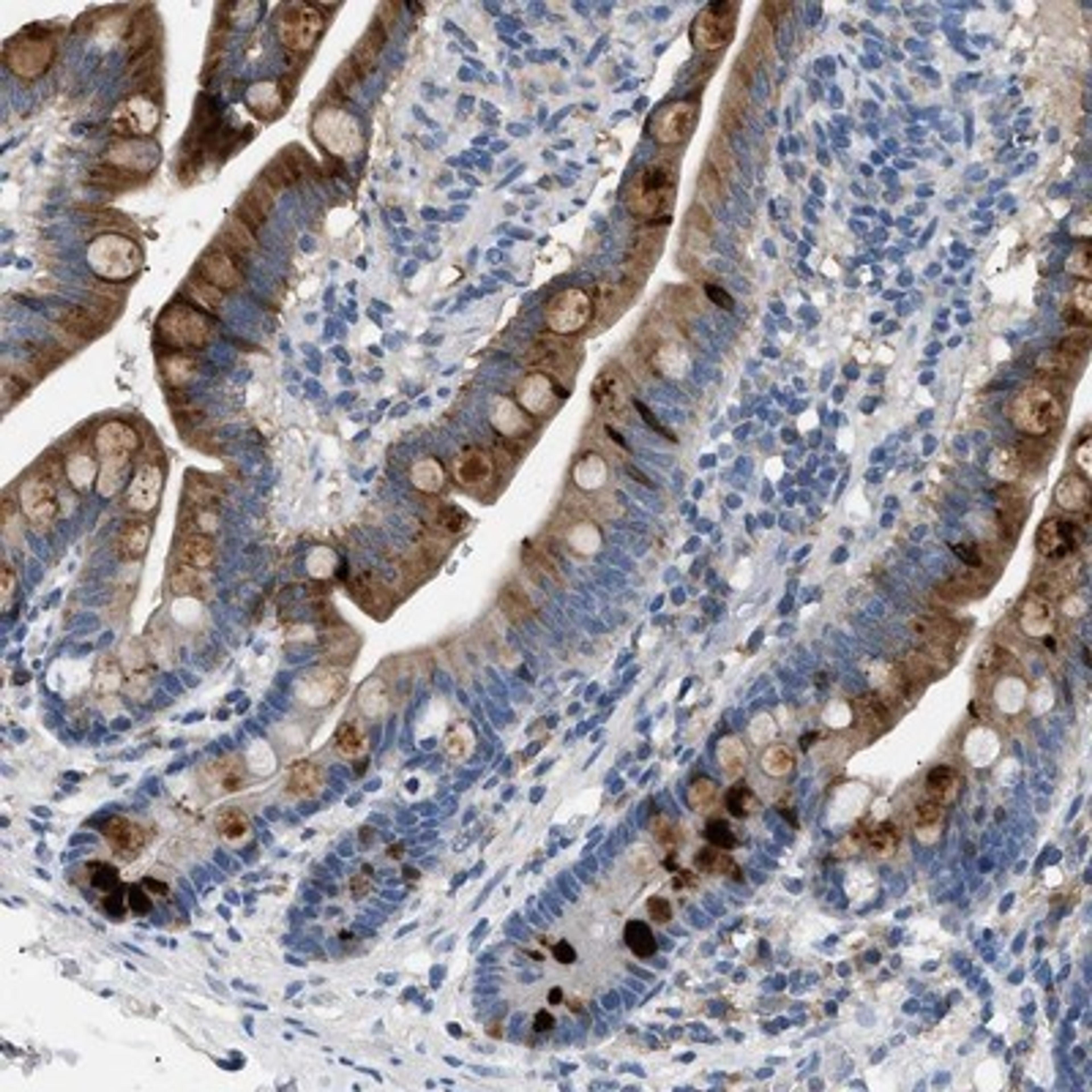 Immunohistochemistry-Paraffin: Guanylin Antibody [NBP1-89724] - Staining of human small intestine shows strong cytoplasmic positivity in glandular cells.