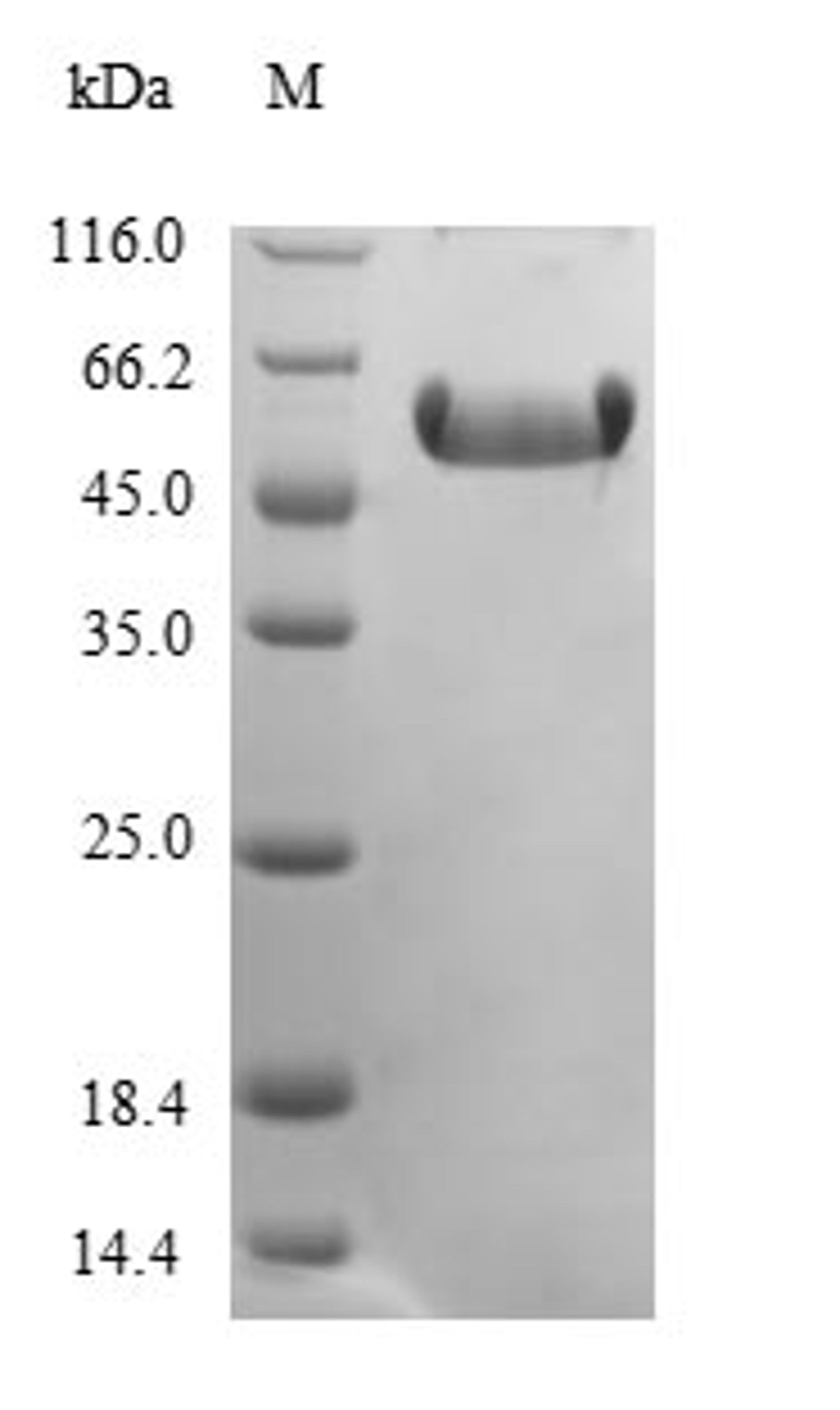 (Tris-Glycine gel) Discontinuous SDS-PAGE (reduced) with 5% enrichment gel and 15% separation gel.