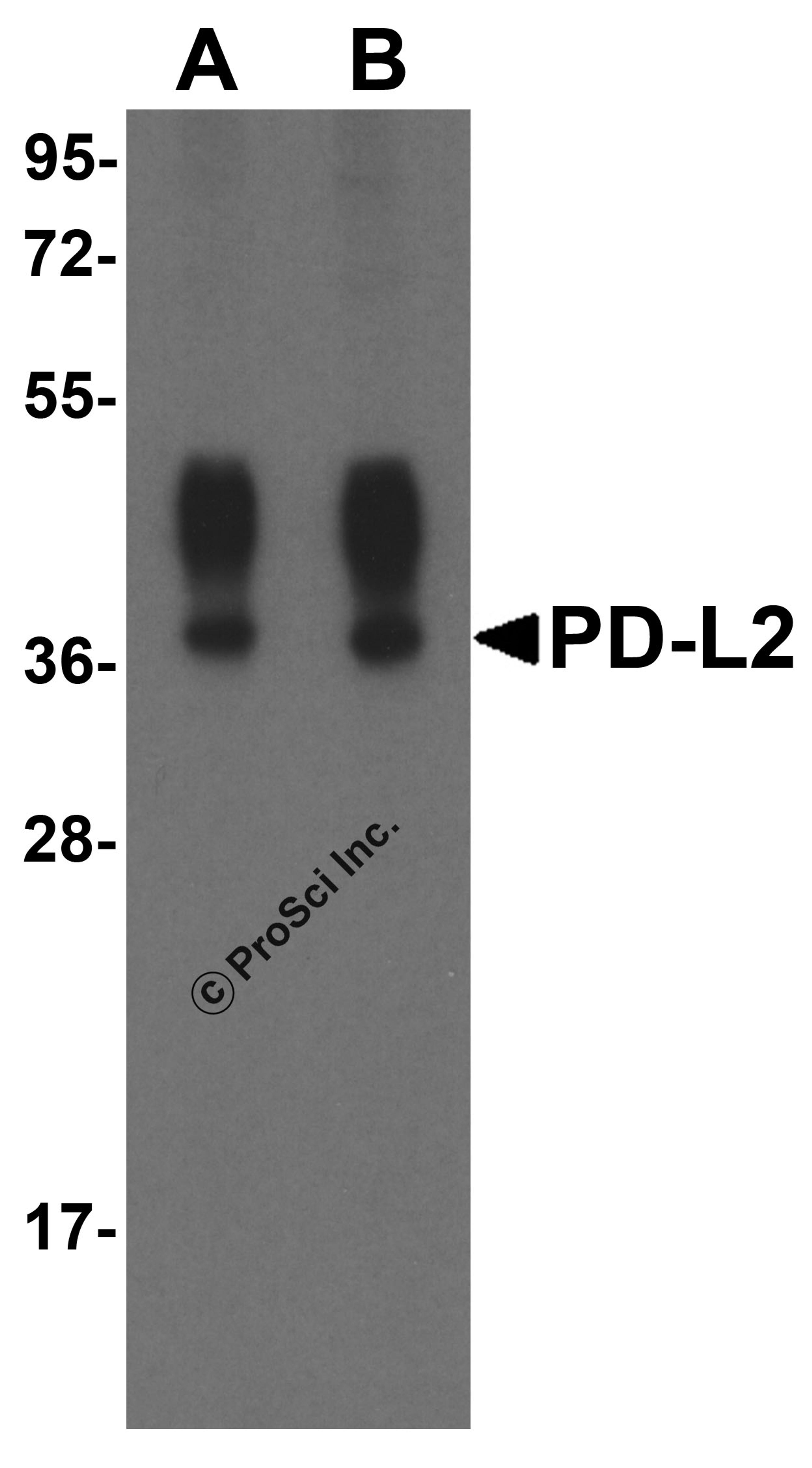 Western blot analysis of PD-L2 in overexpressing HEK293 cells PD-L2 antibody at 0.5 and 1 &#956;g/ml