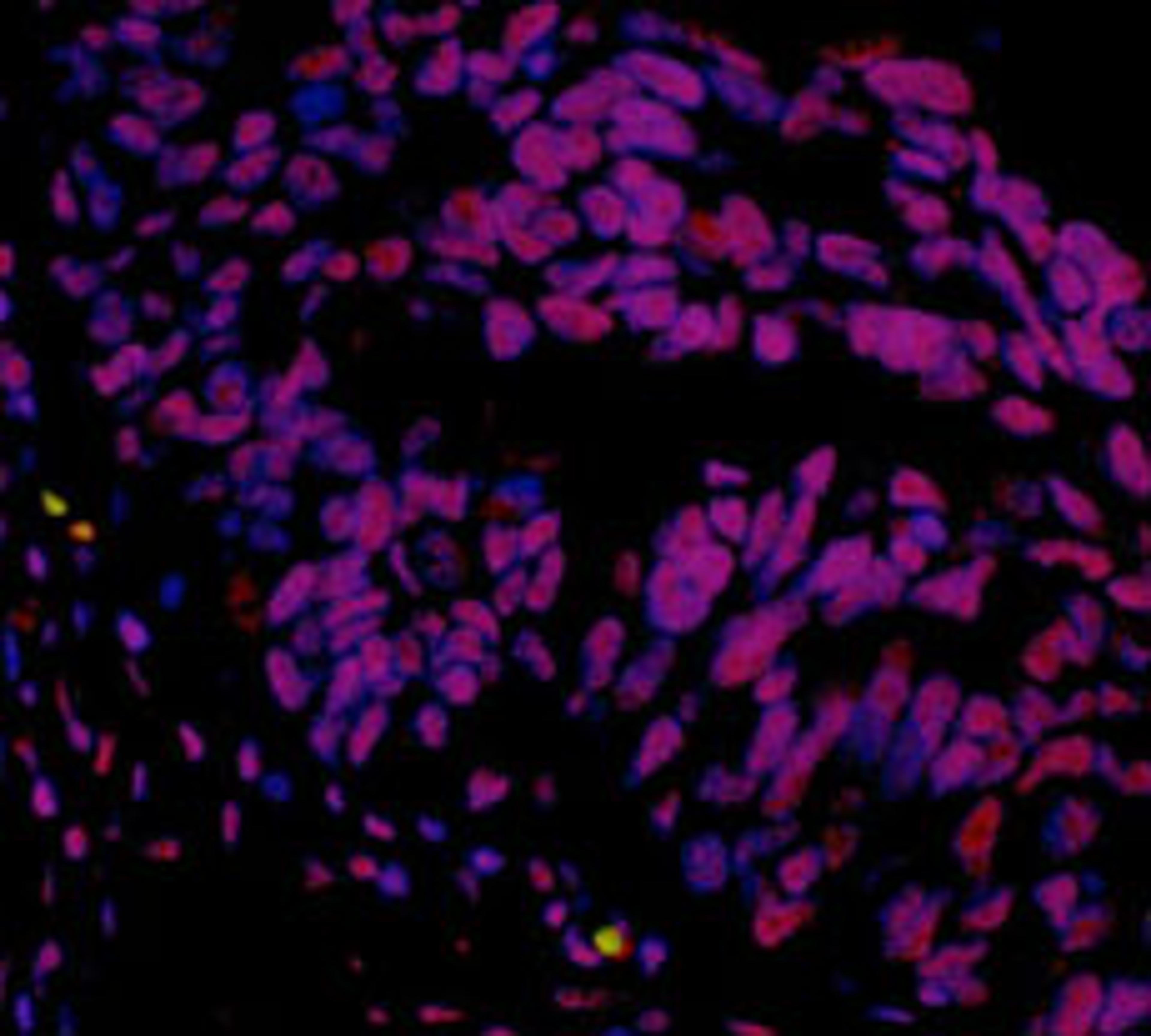 Detection of human hSET1 by immunohistochemistry.