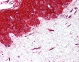 Immunohistochemistry staining of MMP2 in skin, fibroblasts tissue using MMP2 Antibody.