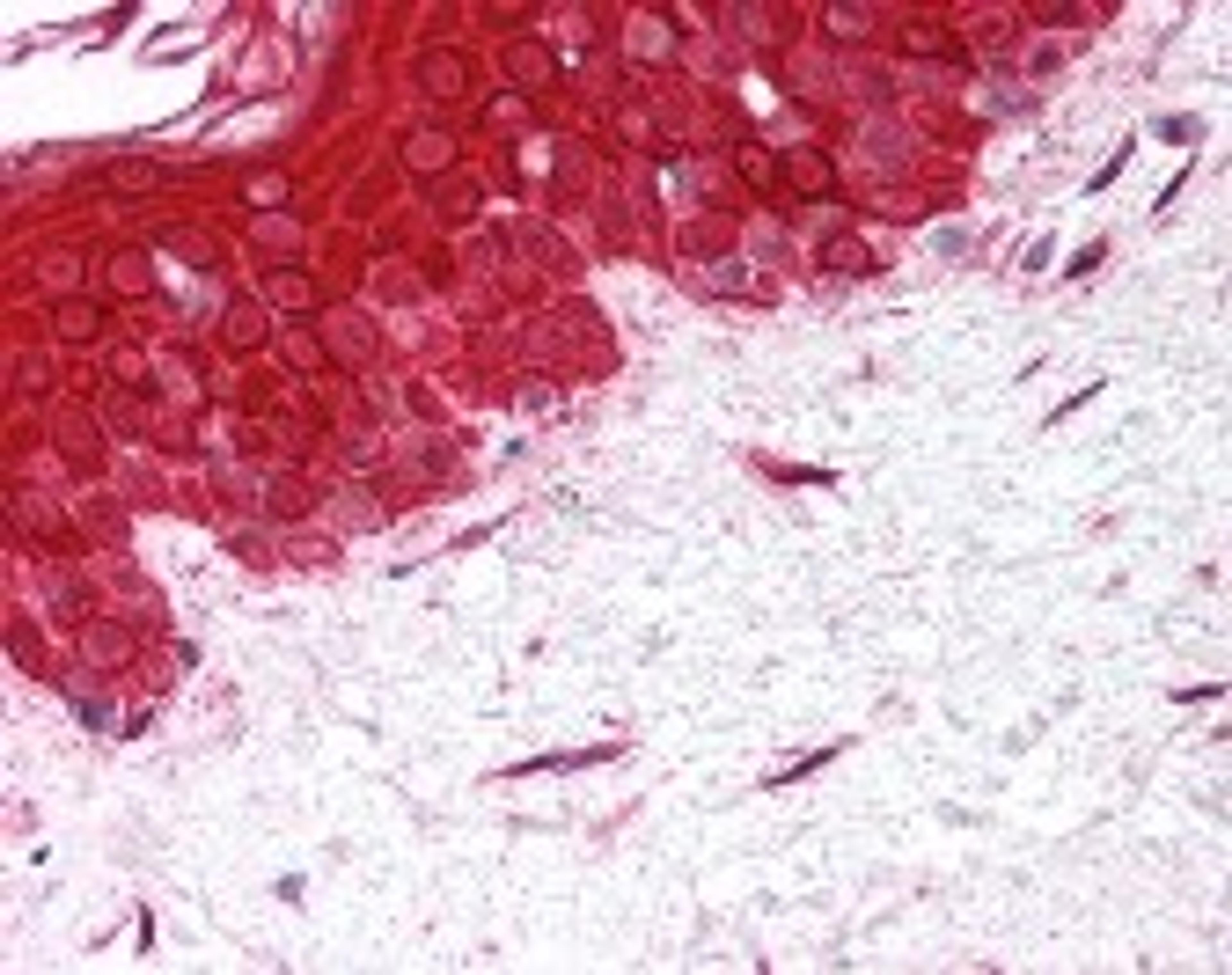 Immunohistochemistry staining of MMP2 in skin, fibroblasts tissue using MMP2 Antibody.