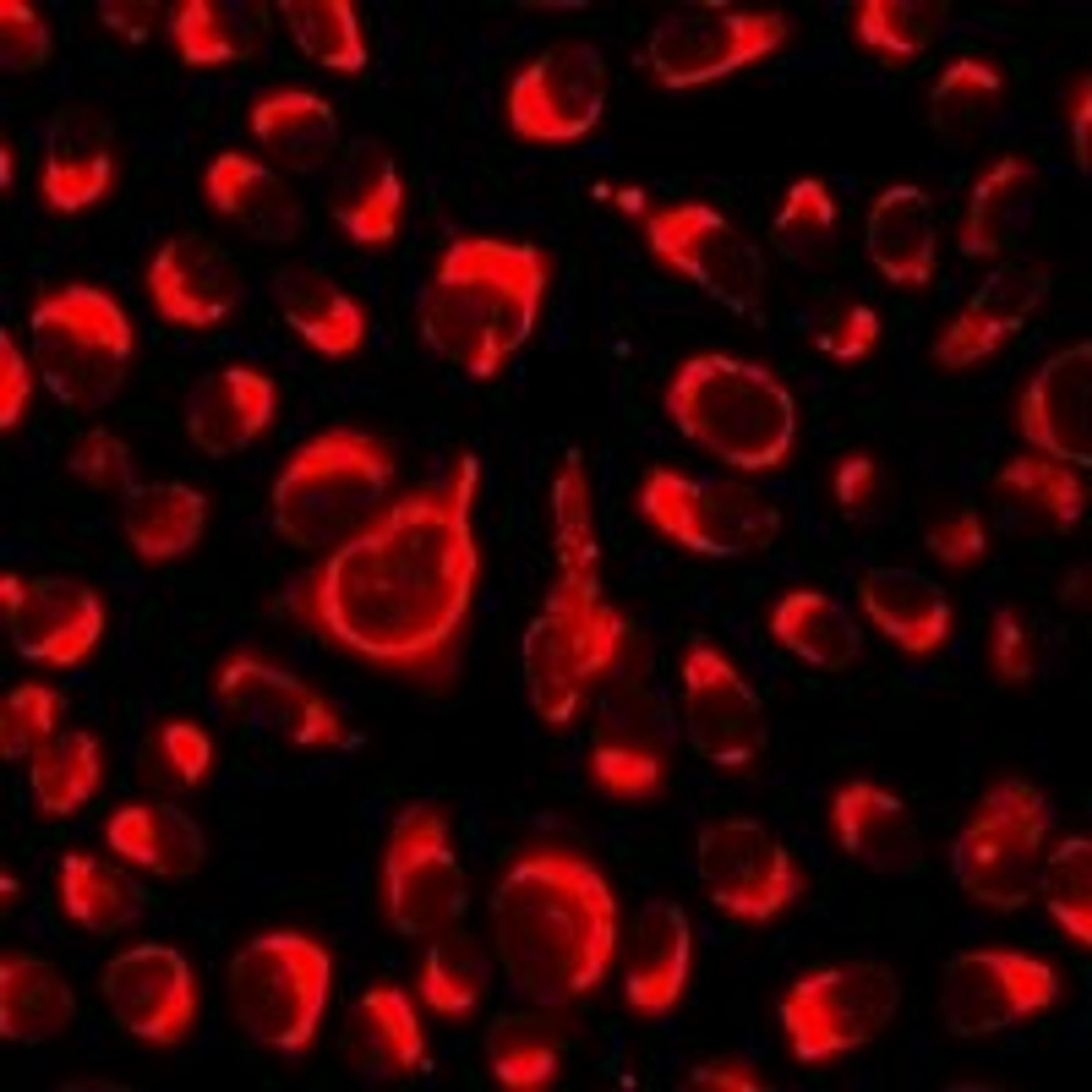 Immunofluorescent analysis of A549 cells using NLRC4 antibody