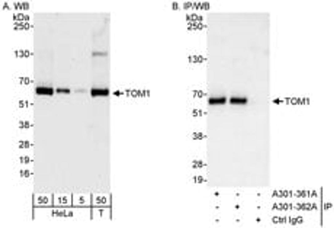 Detection of human TOM1 by western blot and immunoprecipitation.