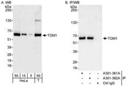 Detection of human TOM1 by western blot and immunoprecipitation.