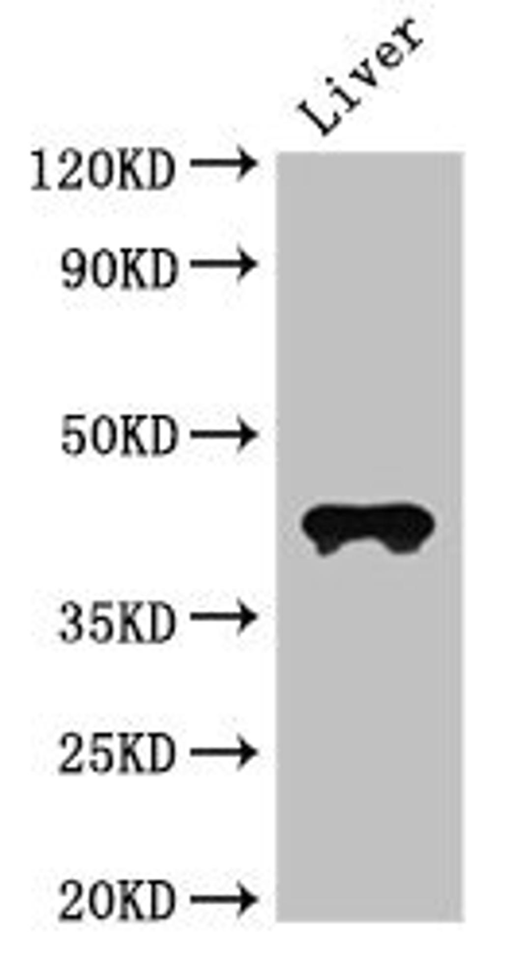 Western Blot. Positive WB detected in: Mouse liver tissue. All lanes: CCR3 antibody at 3ug/ml. Secondary. Goat polyclonal to rabbit IgG at 1/50000 dilution. predicted band size: 42, 44 kDa. observed band size: 42 kDa. 