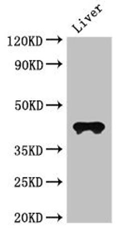Western Blot. Positive WB detected in: Mouse liver tissue. All lanes: CCR3 antibody at 3ug/ml. Secondary. Goat polyclonal to rabbit IgG at 1/50000 dilution. predicted band size: 42, 44 kDa. observed band size: 42 kDa. 