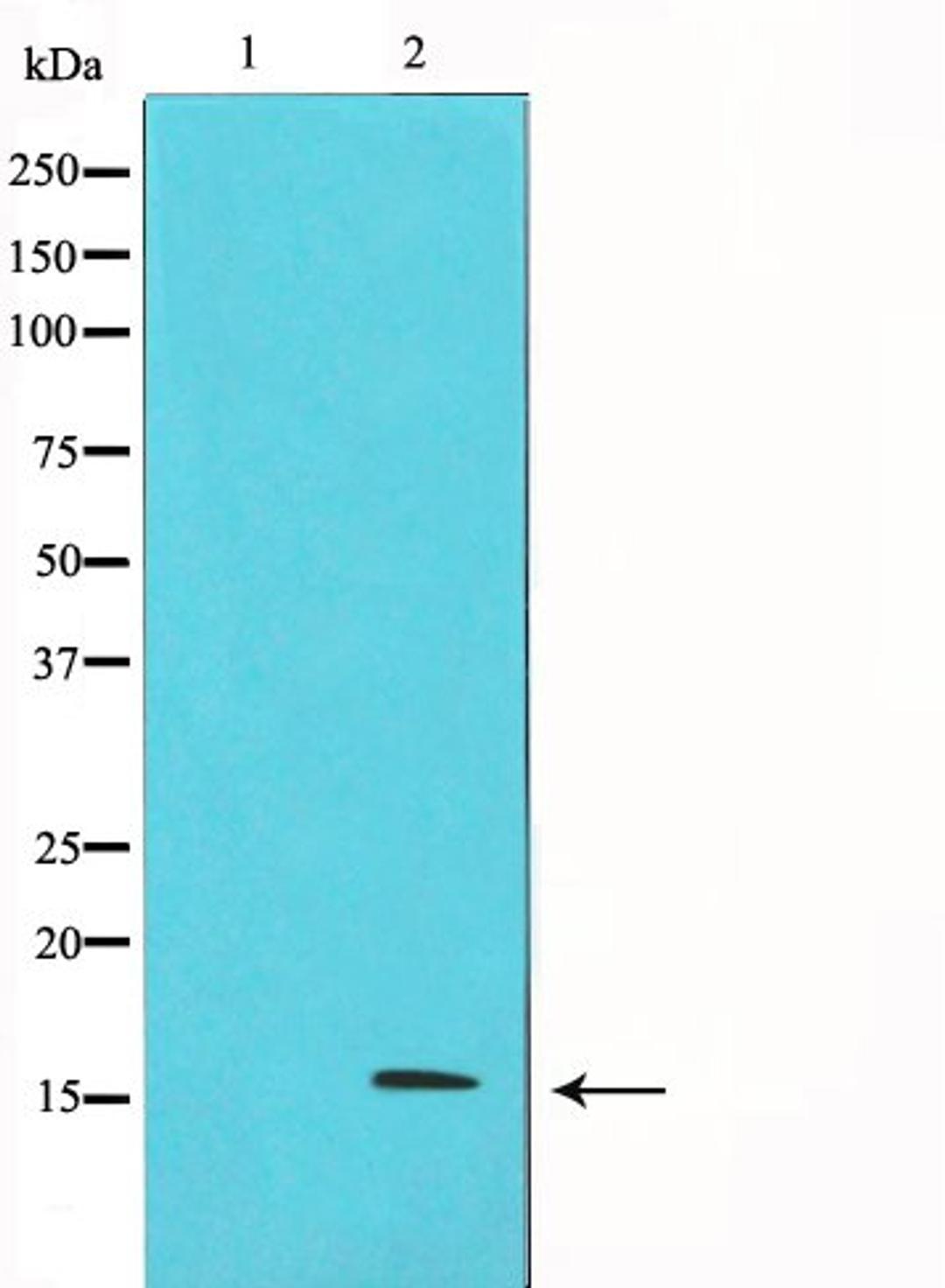 Western blot analysis of HeLa cell lysate using p16 INK antibody