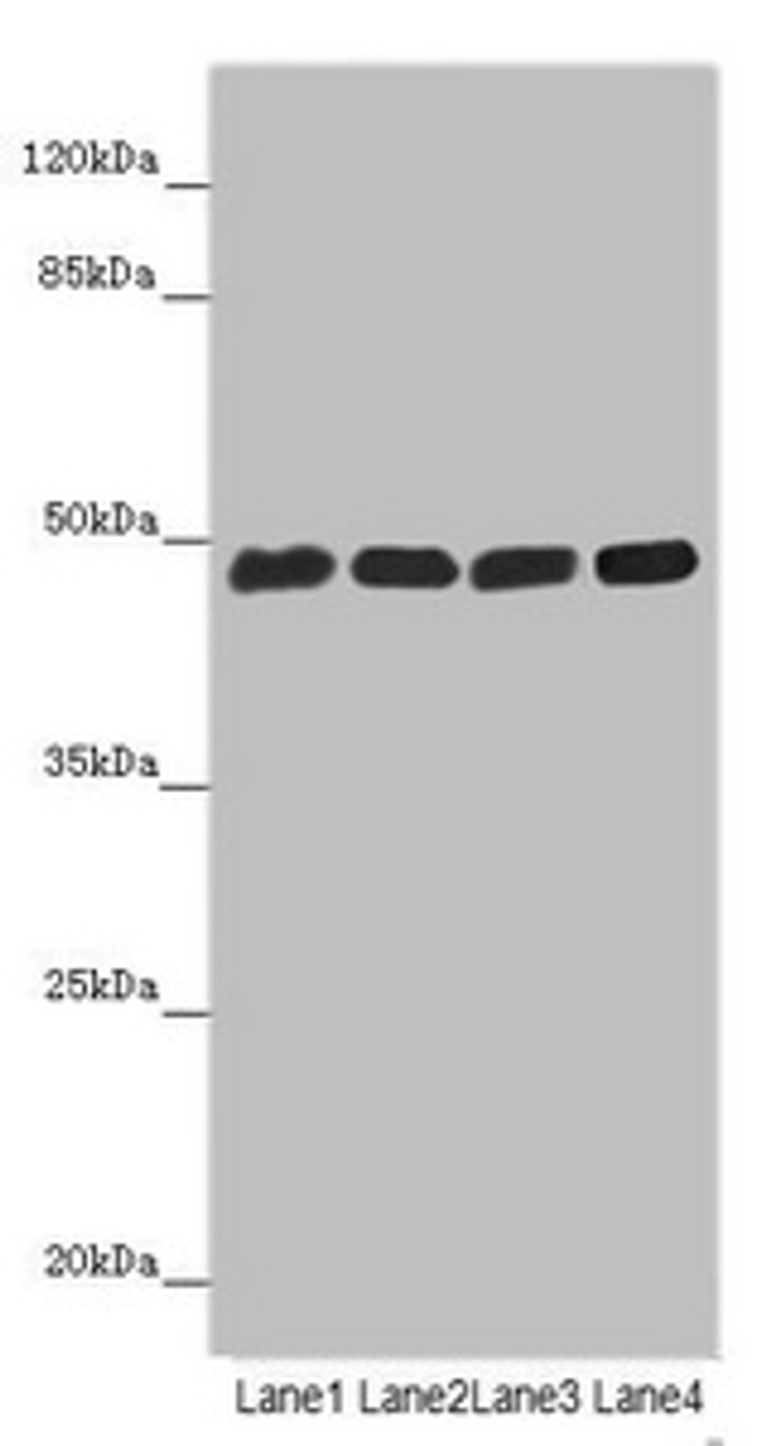 Western blot. All lanes: ST3GAL5 antibody at 4.8µg/ml. Lane 1: Hela whole cell lysate. Lane 2: 293T whole cell lysate. Lane 3: Jurkat whole cell lysate. Lane 4: U251 whole cell lysate. Secondary. Goat polyclonal to rabbit IgG at 1/10000 dilution. Predicted band size: 48, 46 kDa. Observed band size: 48 kDa