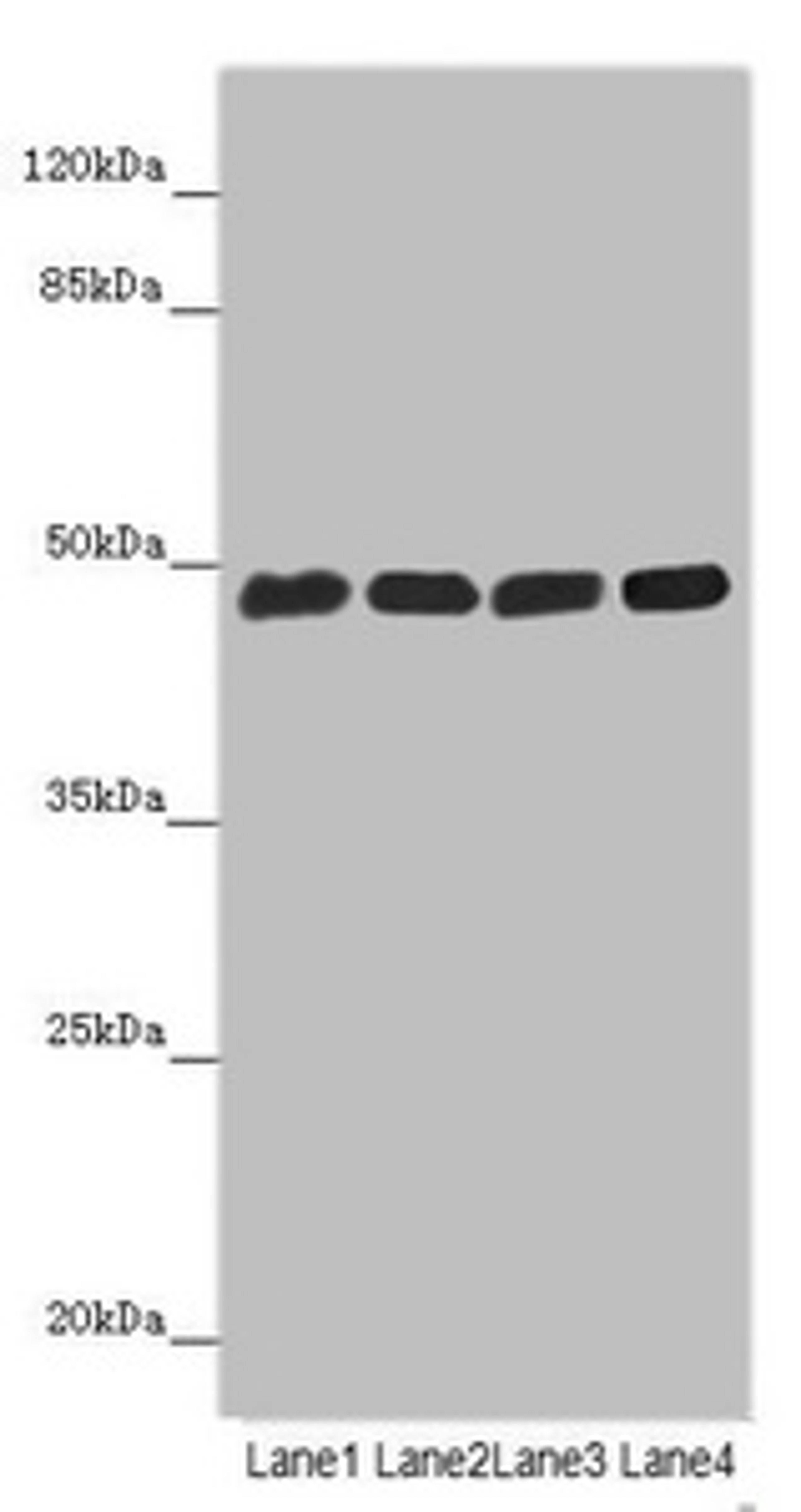 Western blot. All lanes: ST3GAL5 antibody at 4.8µg/ml. Lane 1: Hela whole cell lysate. Lane 2: 293T whole cell lysate. Lane 3: Jurkat whole cell lysate. Lane 4: U251 whole cell lysate. Secondary. Goat polyclonal to rabbit IgG at 1/10000 dilution. Predicted band size: 48, 46 kDa. Observed band size: 48 kDa