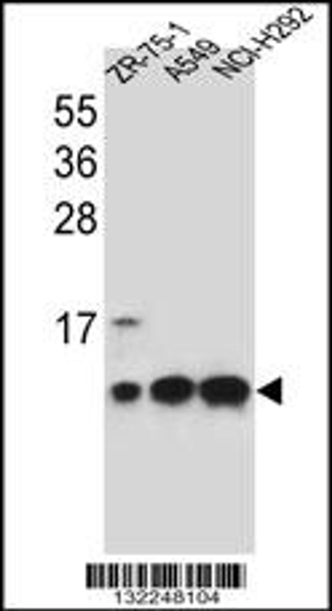 Western blot analysis in ZR-75-1,A549,NCI-H292 cell line lysates (35ug/lane).