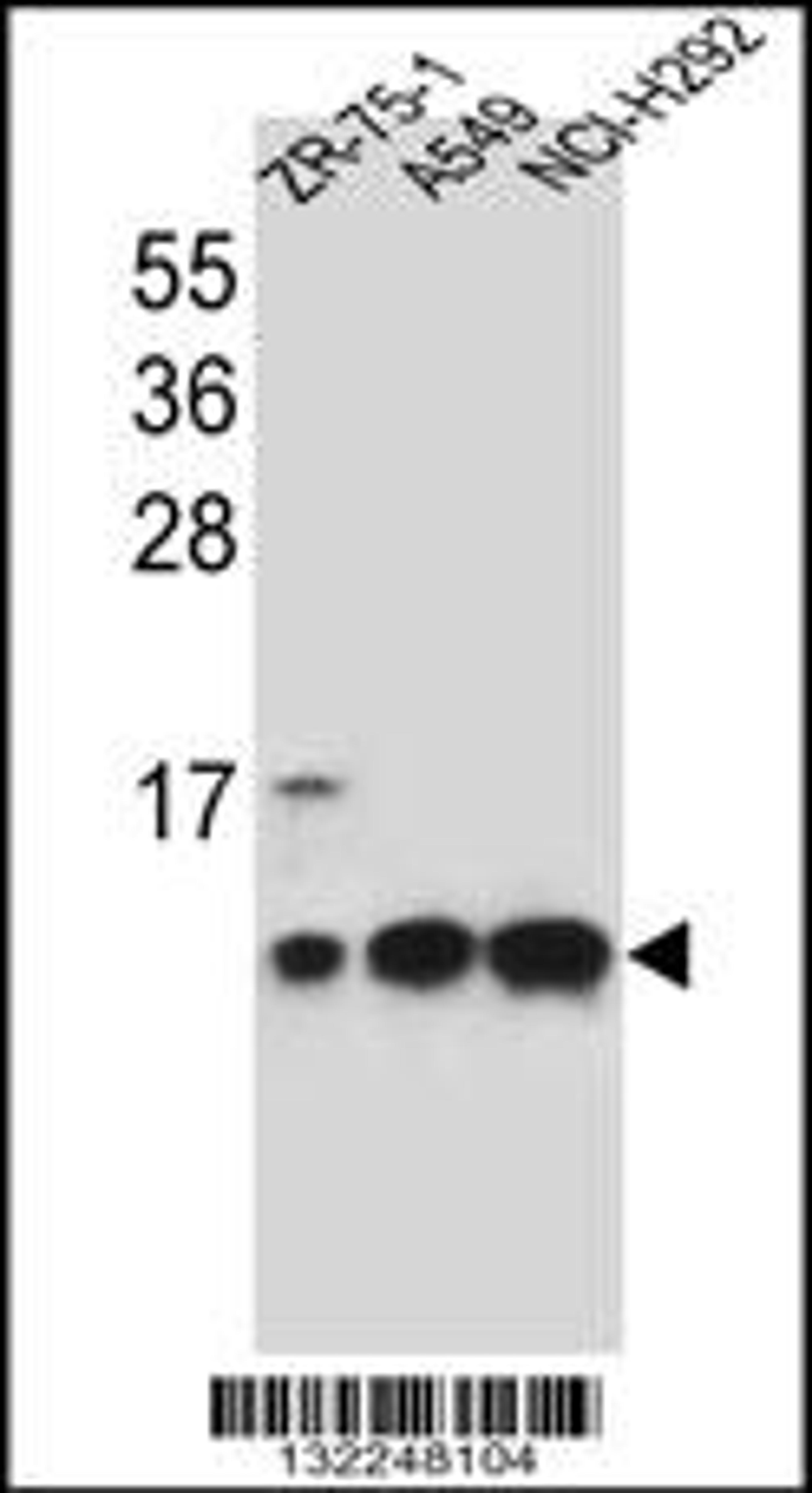 Western blot analysis in ZR-75-1,A549,NCI-H292 cell line lysates (35ug/lane).