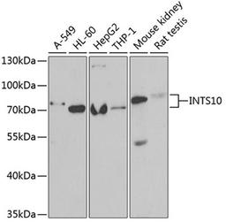 Western blot - INTS10 antibody (A6632)