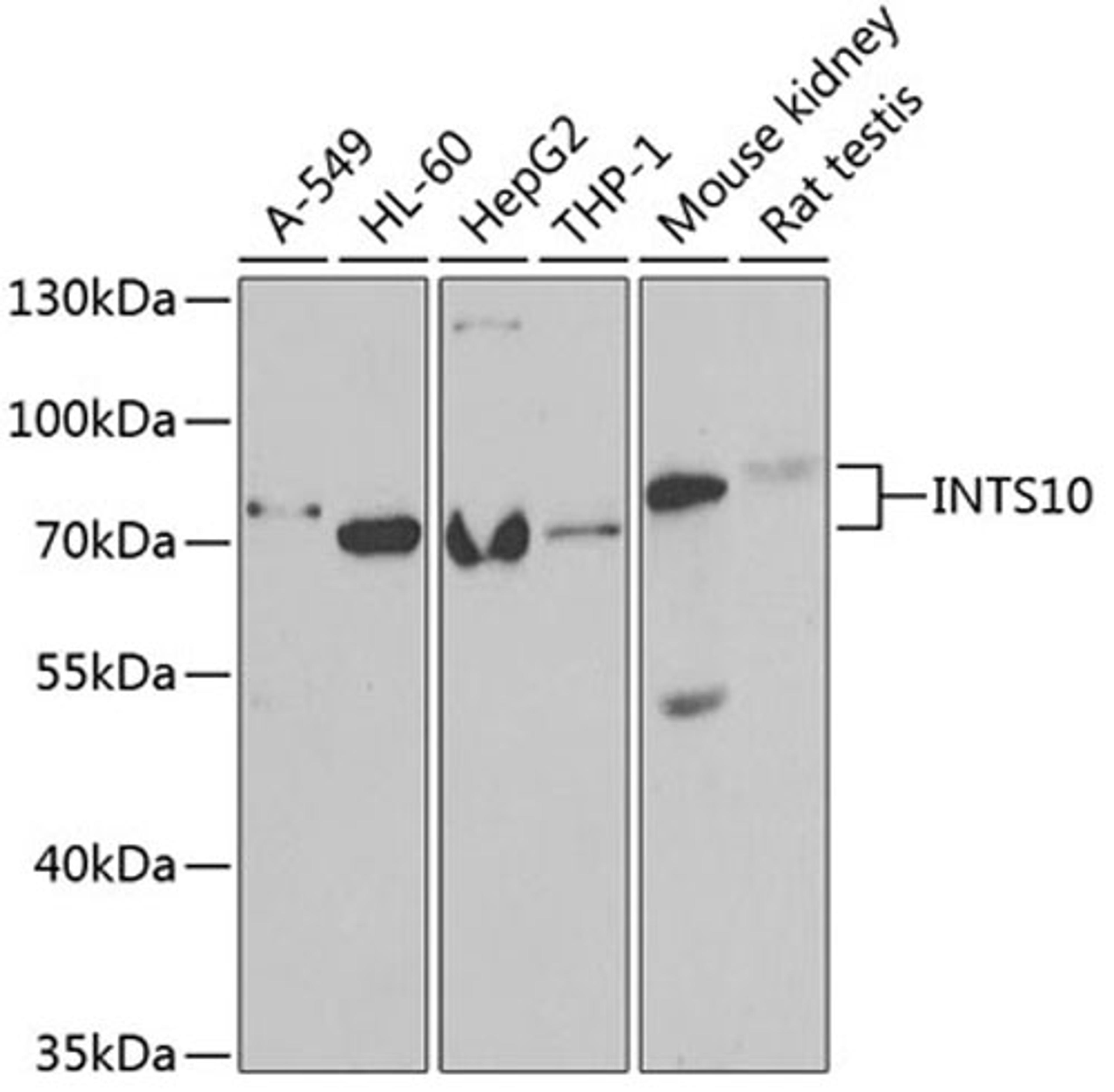 Western blot - INTS10 antibody (A6632)