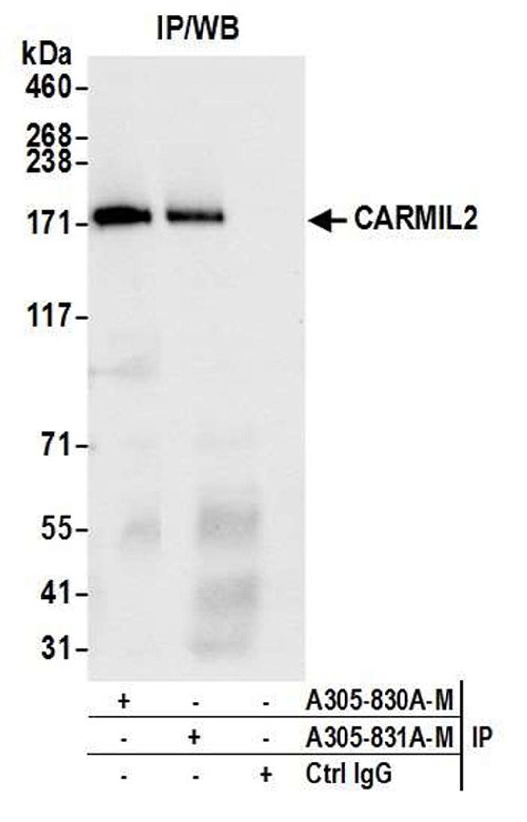 Detection of human CARMIL2 by WB of IP.