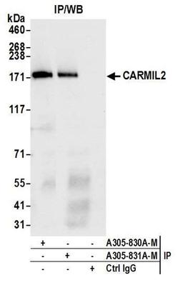 Detection of human CARMIL2 by WB of IP.