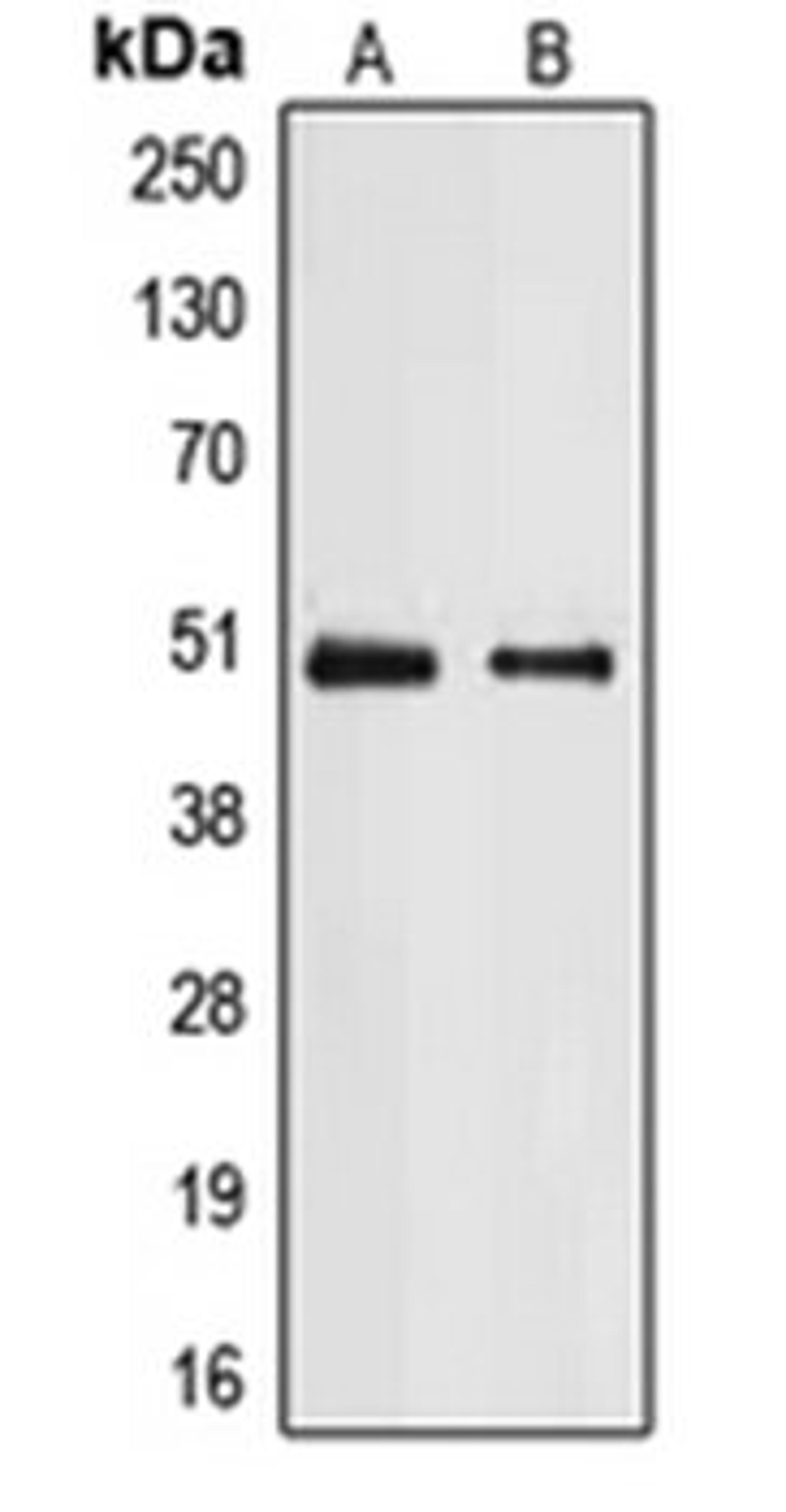 Western blot analysis of A431 (Lane 1), Jurkat (Lane 2) whole cell lysates using E2F2 antibody