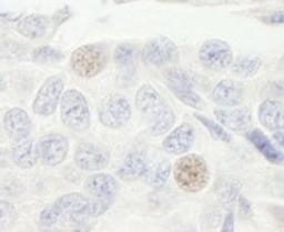 Detection of human GTF3C2/TFIIIC110 by immunohistochemistry.