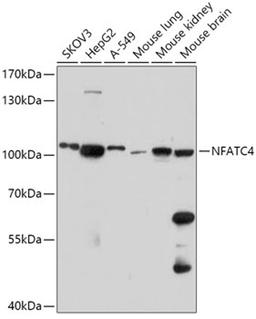 Western blot - NFATC4 antibody (A17511)