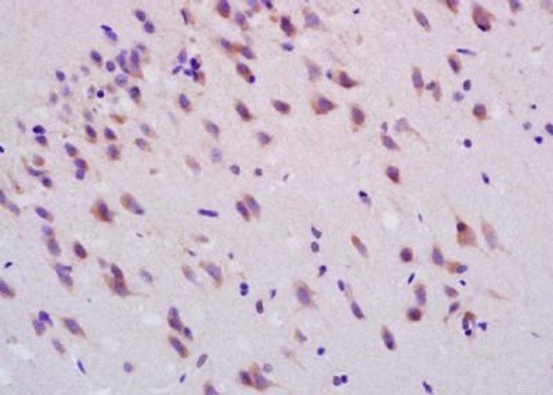 Immunohistochemical analysis of formalin-fixed paraffin embedded rat brain tissue using Smoothened antibody (dilution at 1:200)