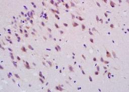 Immunohistochemical analysis of formalin-fixed paraffin embedded rat brain tissue using Smoothened antibody (dilution at 1:200)