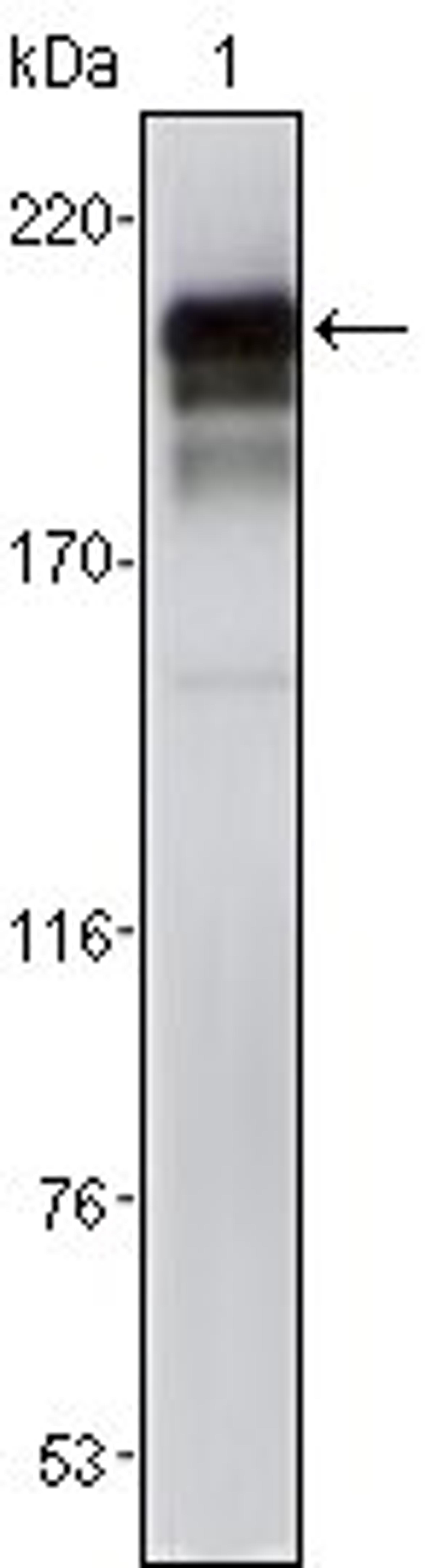 Western blot analysis of NIH/3T3 cell lysate using PDGFRbeta antibody