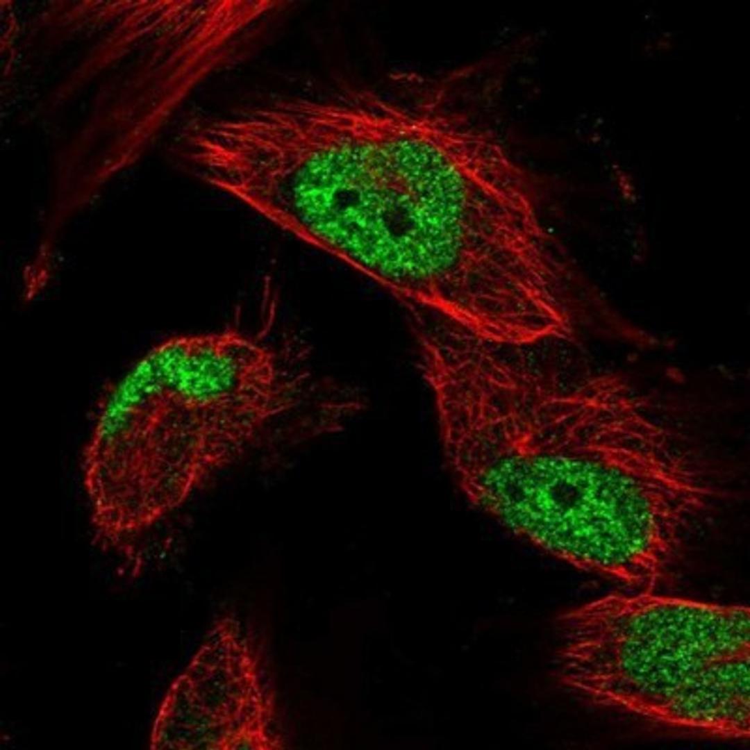 Immunocytochemistry/Immunofluorescence: OBFC1 Antibody [NBP1-88743] - Staining of human cell line U-251 MG shows positivity in nucleus but not nucleoli.