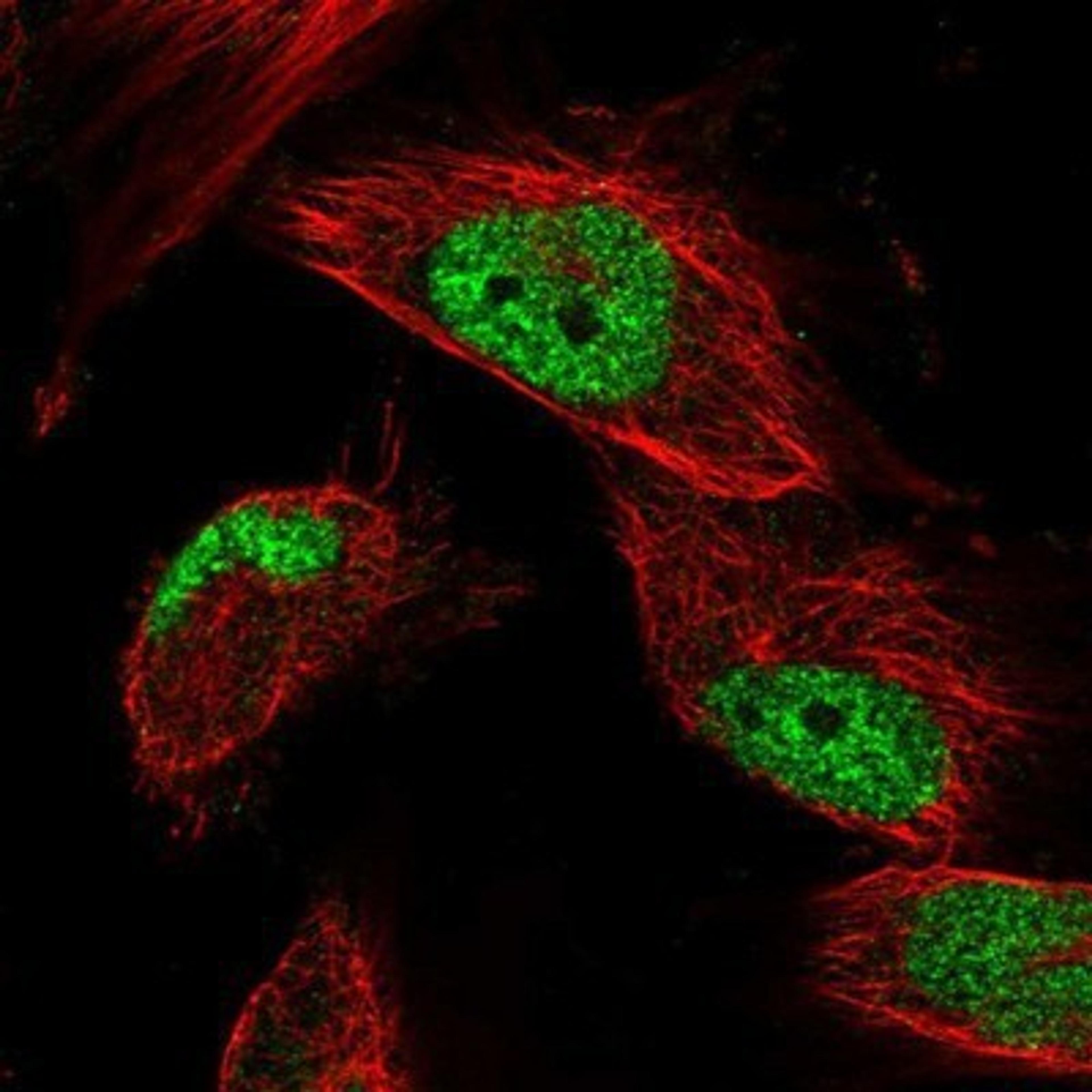 Immunocytochemistry/Immunofluorescence: OBFC1 Antibody [NBP1-88743] - Staining of human cell line U-251 MG shows positivity in nucleus but not nucleoli.