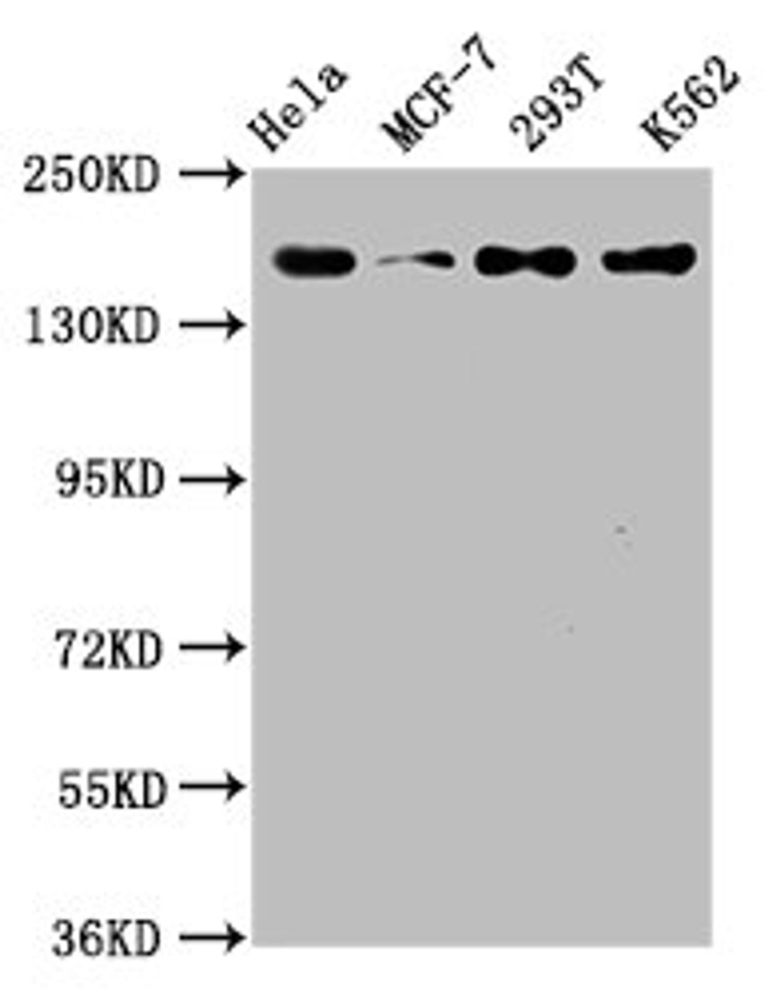 Western Blot. Positive WB detected in: Hela whole cell lysate, MCF-7 whole cell lysate, 293T whole cell lysate, K562 whole cell lysate. All lanes: HDAC9 antibody at 1.54μg/ml. Secondary. Goat polyclonal to rabbit IgG at 1/50000 dilution. Predicted band size: 112, 102, 66, 98, 118, 113, 61, 63, 58 KDa. Observed band size: 160 KDa.