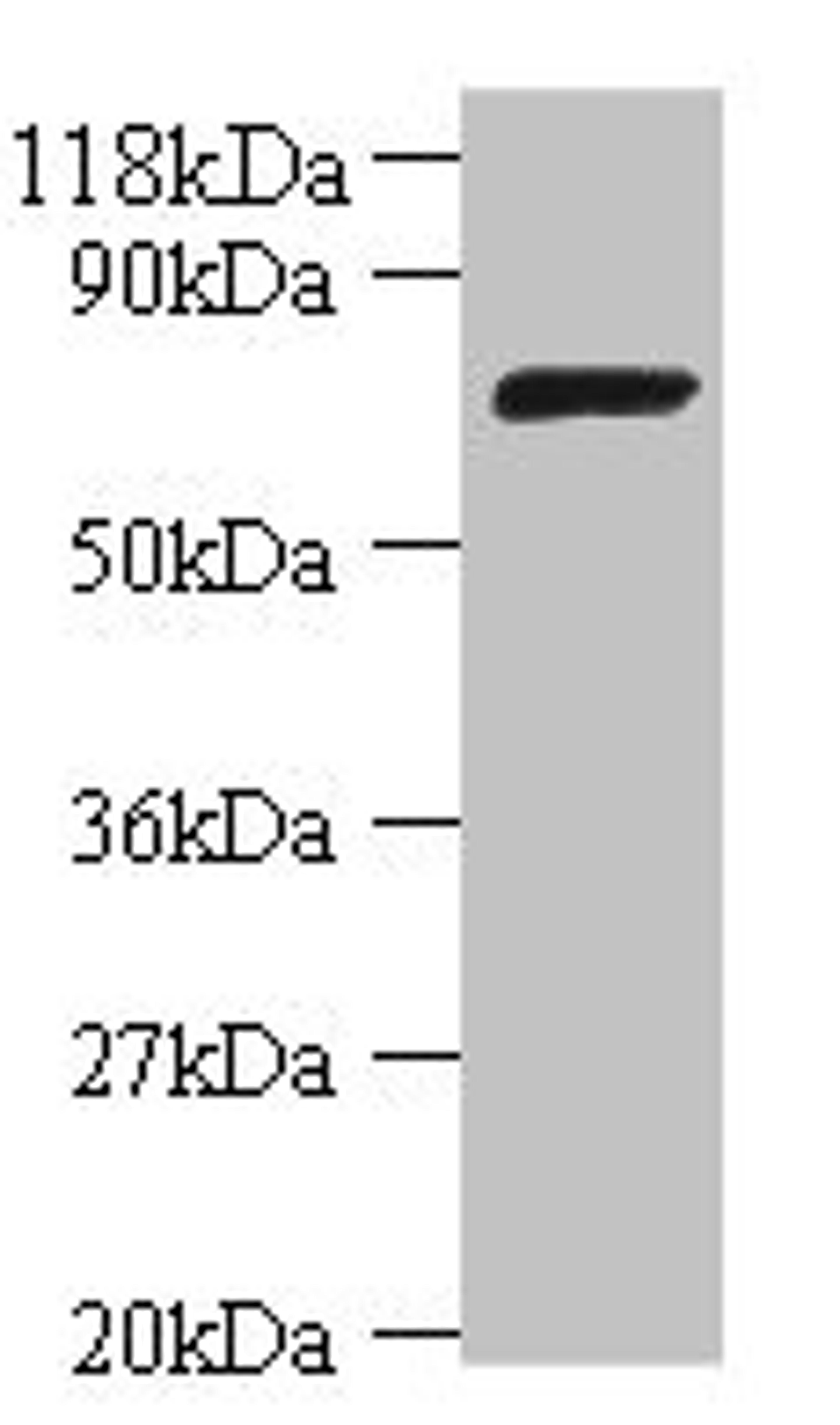Western blot. All lanes: DNA ligase antibody at 2ug/ml + DH5a whole cell lysate. Secondary. Goat polyclonal to rabbit IgG at 1/10000 dilution. Predicted band size: 74 kDa. Observed band size: 74 kDa.