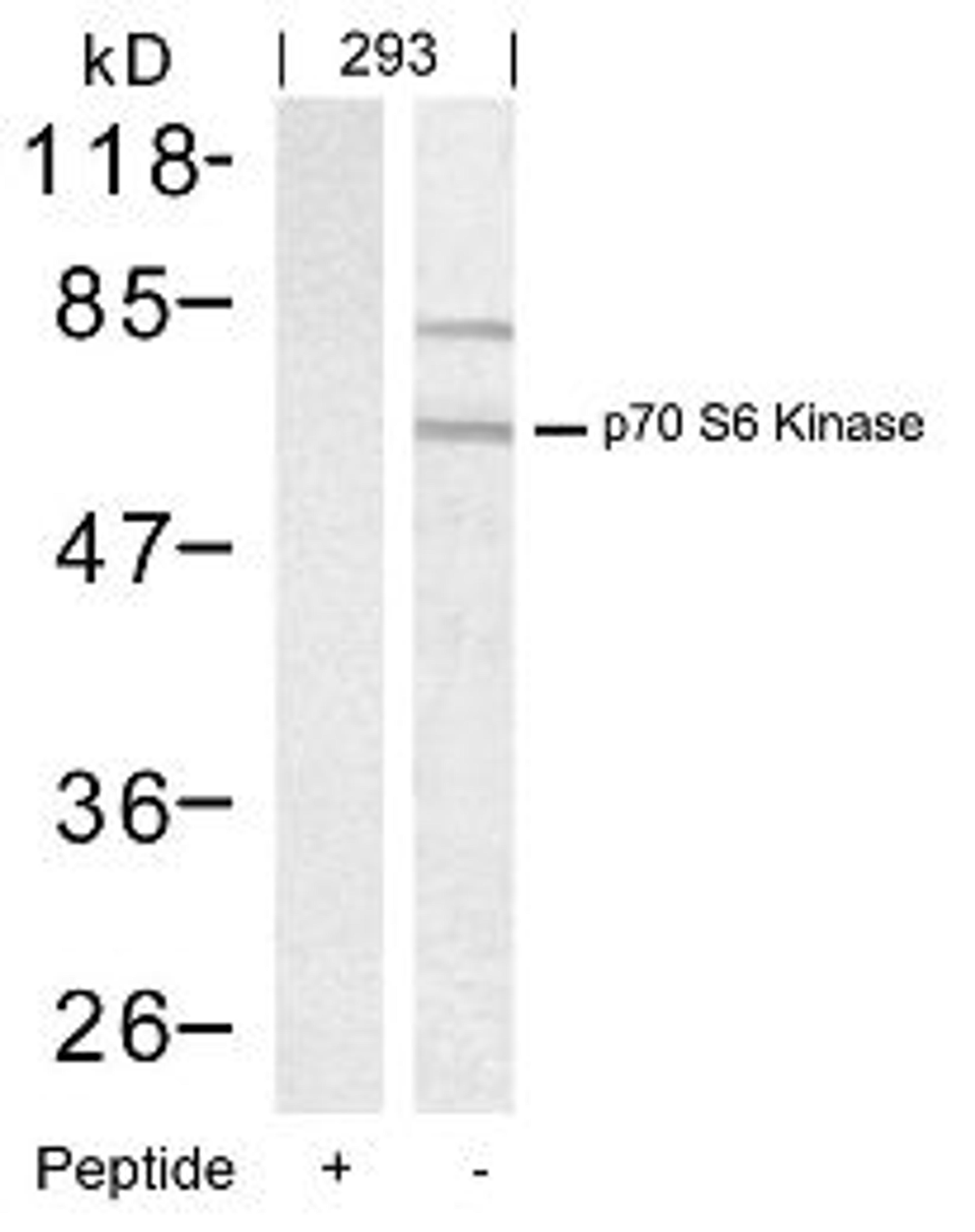 Western blot analysis of lysed extracts from 293 cells using p70 S6 Kinase (Ab-389).